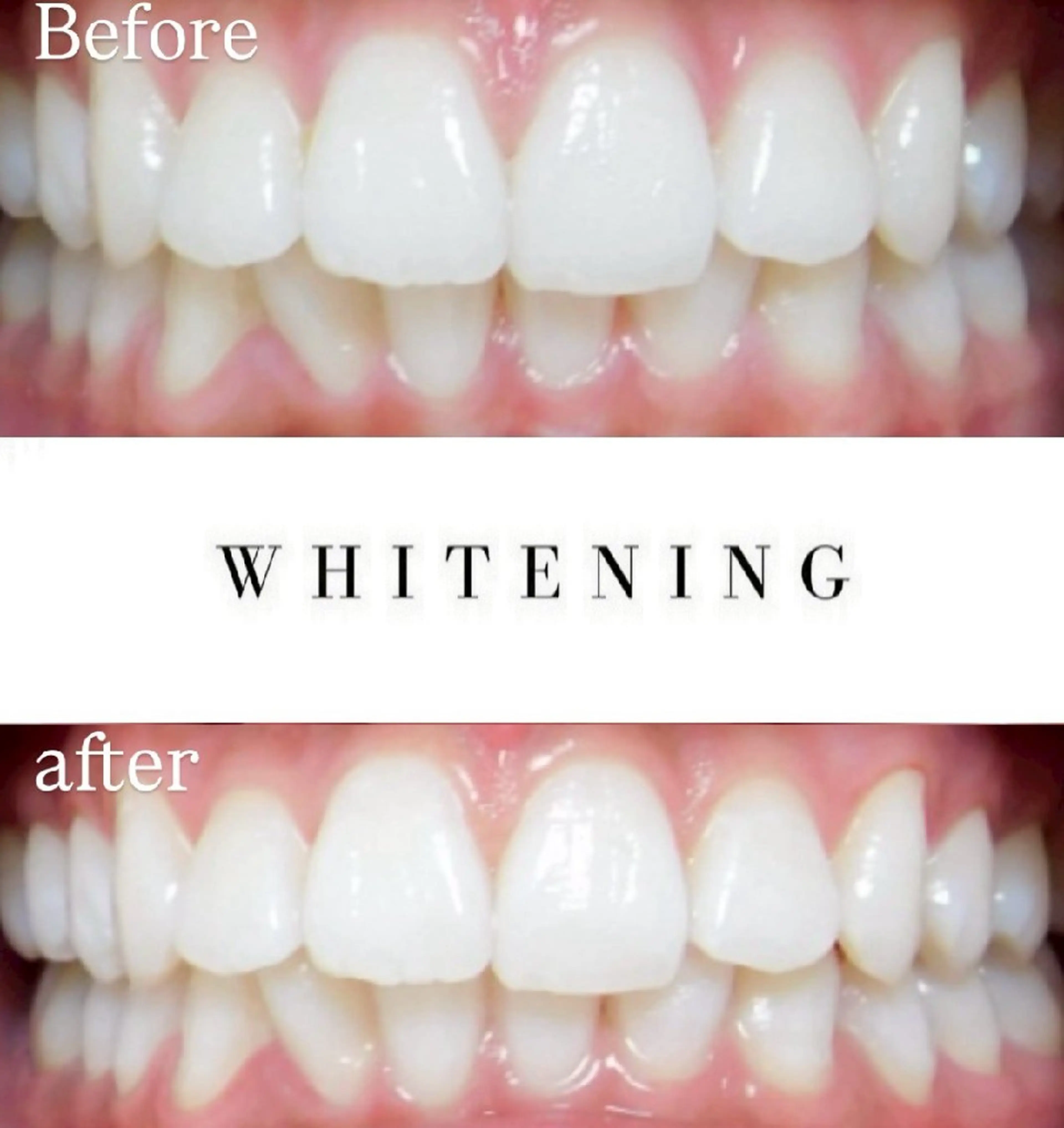 その他 Luv the TERRACEの眉毛・アイブロウイメージ