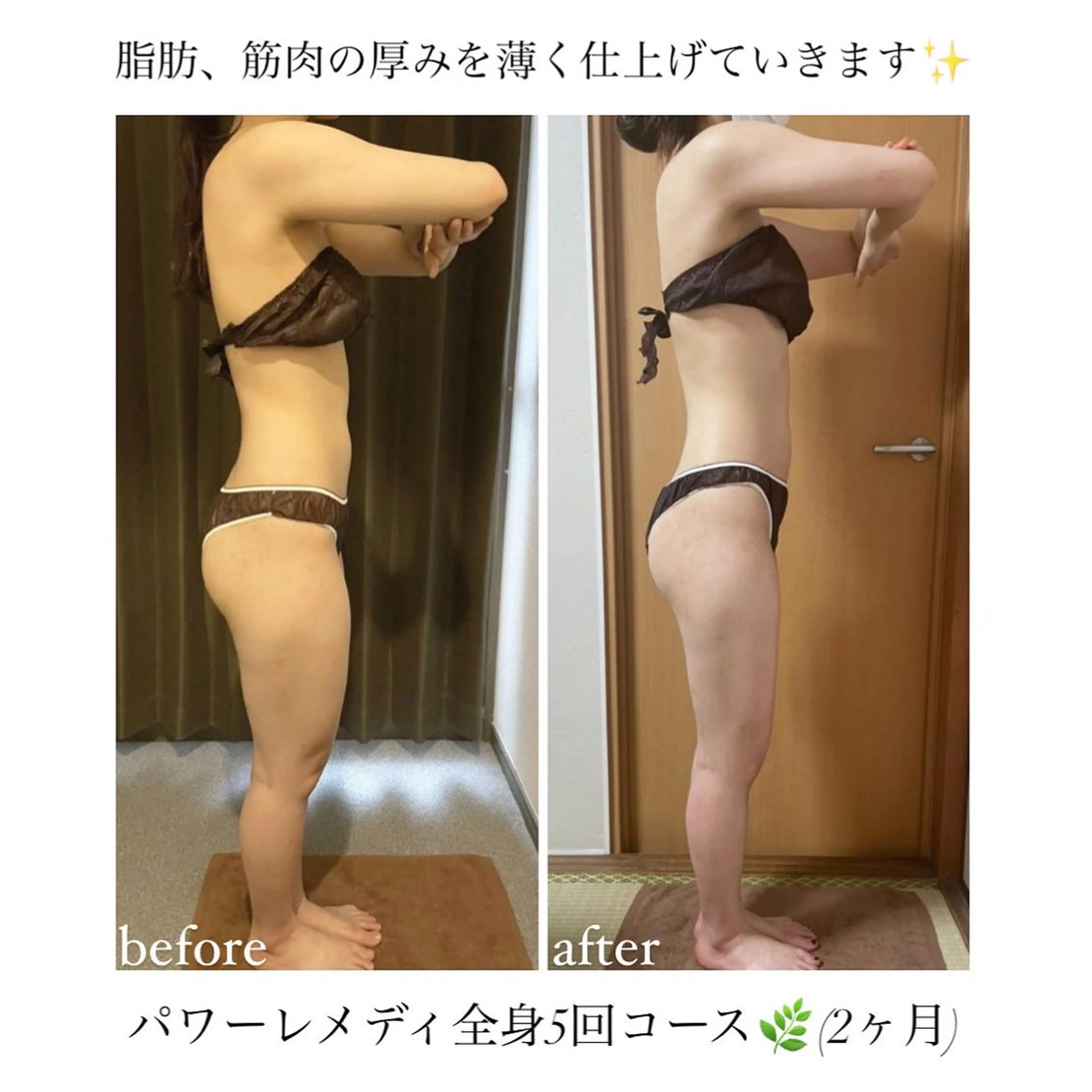 《本気痩せ×疲労改善 》  BILOOPのエステ・リラクイメージ