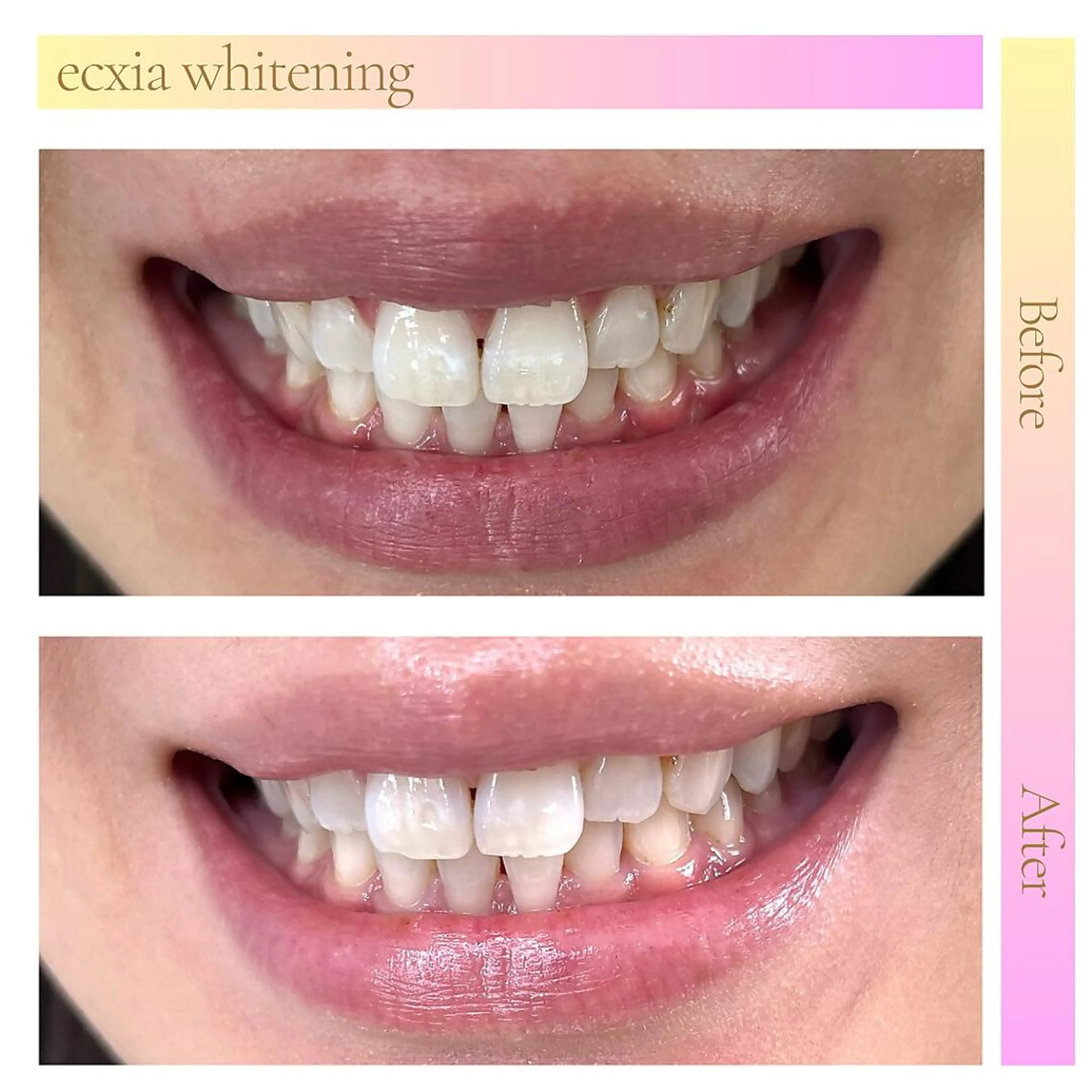 その他 セルフホワイトニング エクシア福島のその他イメージ