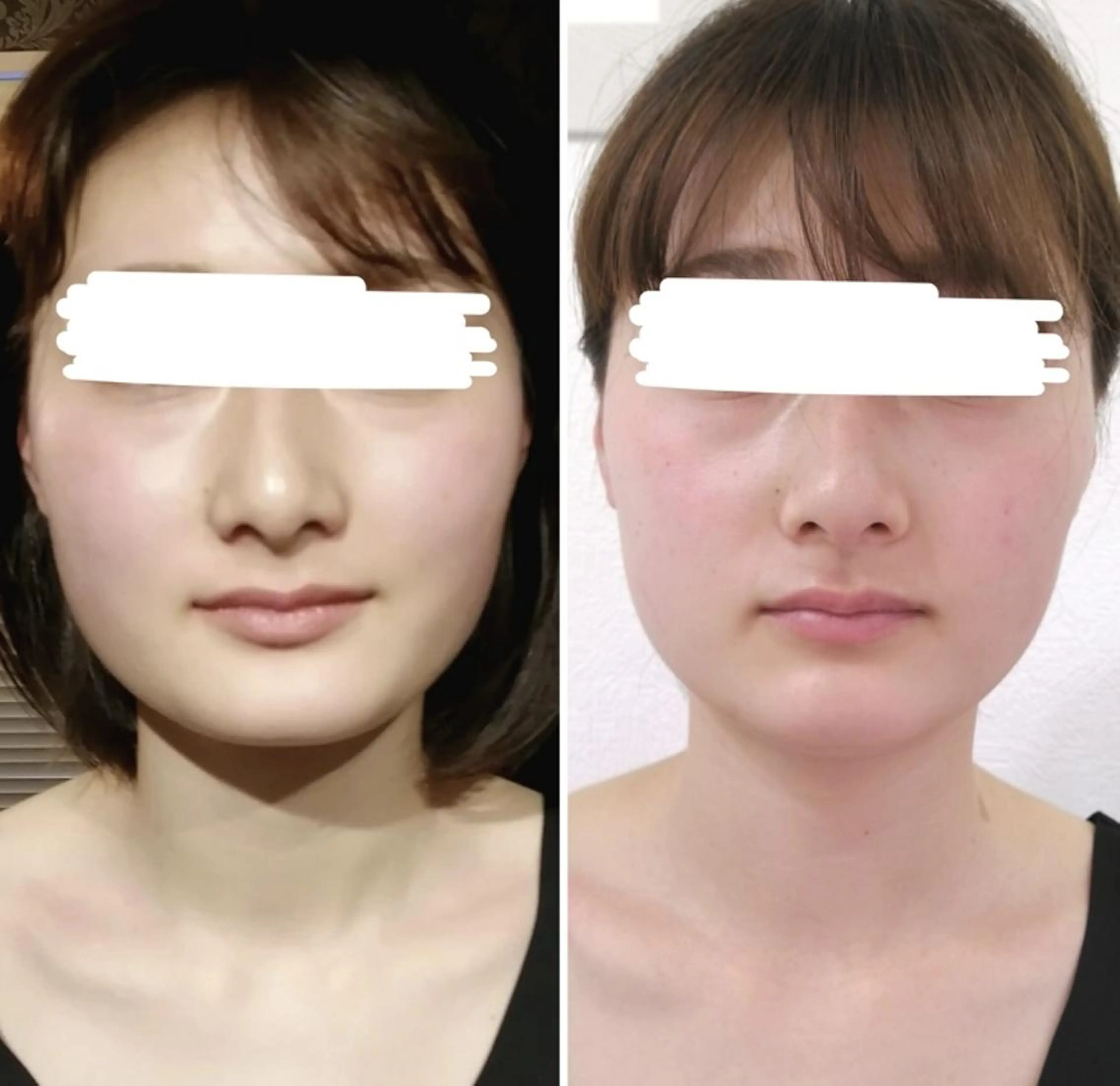 骨格美容整体 bimote.新宿のエステ・リラクイメージ