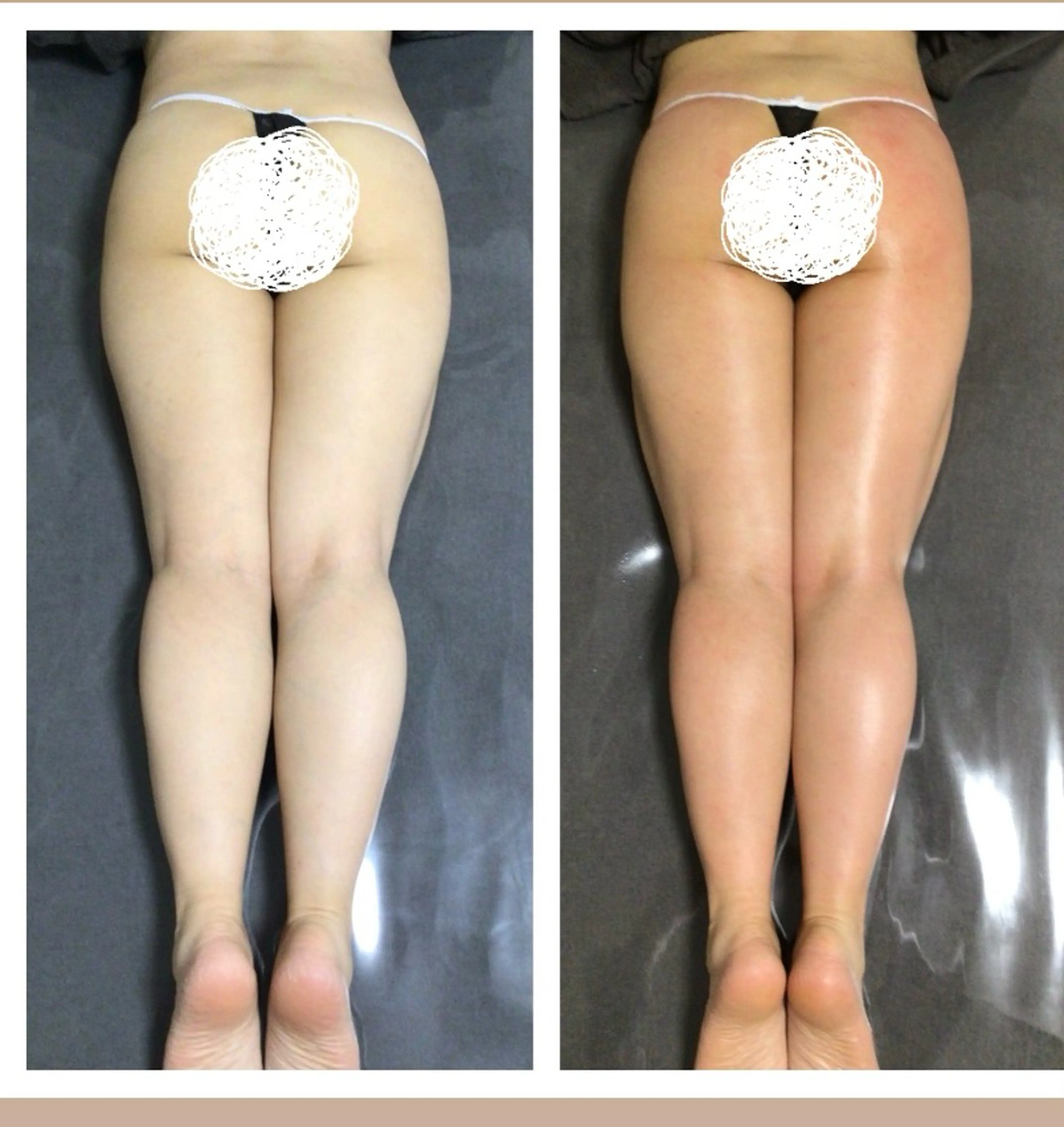 エステ セルライトクラッシュ &腸もみ+骨盤矯正のその他イメージ