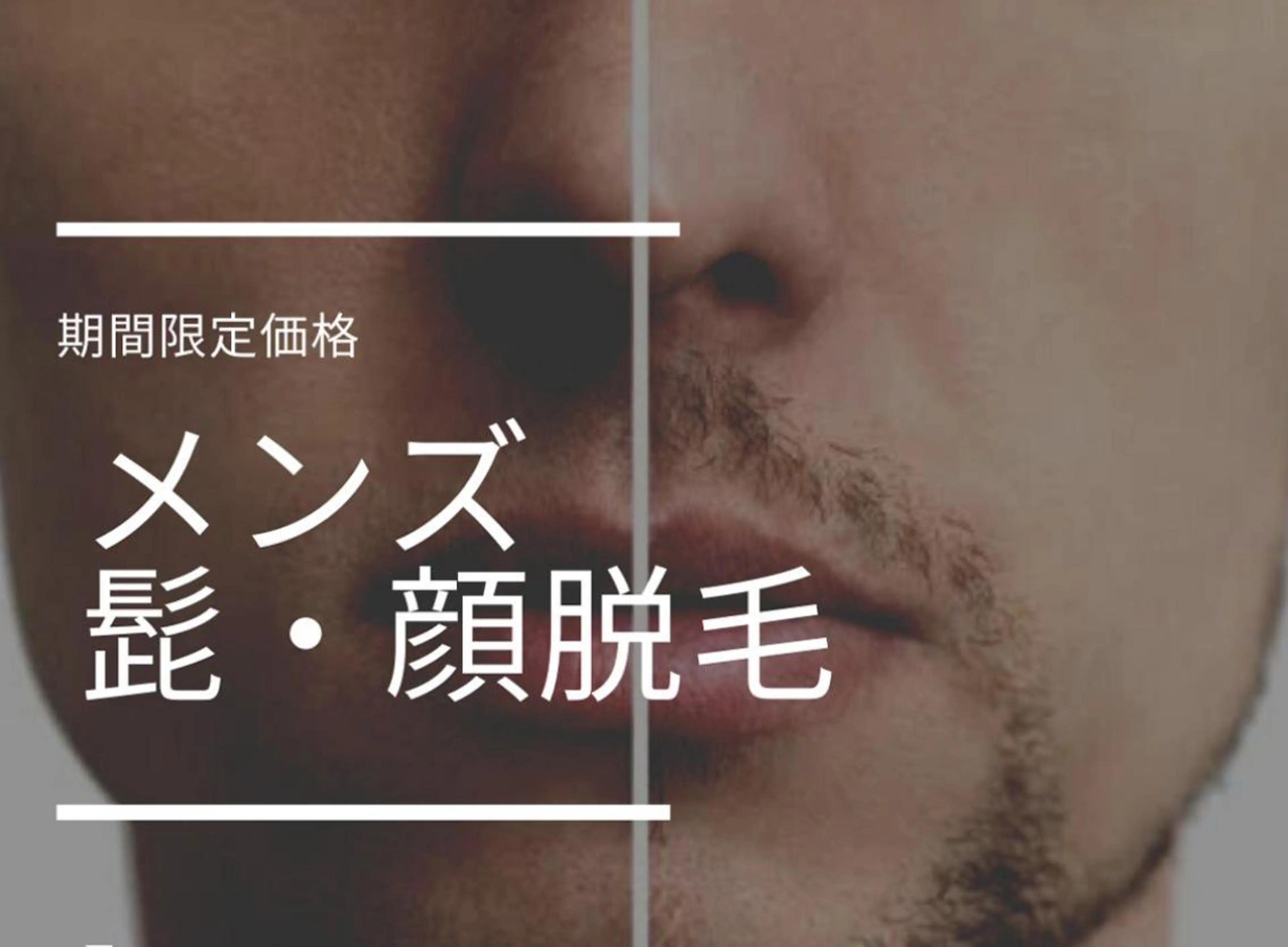 脱毛 脱毛サロンTTe もものエステ・リラクイメージ