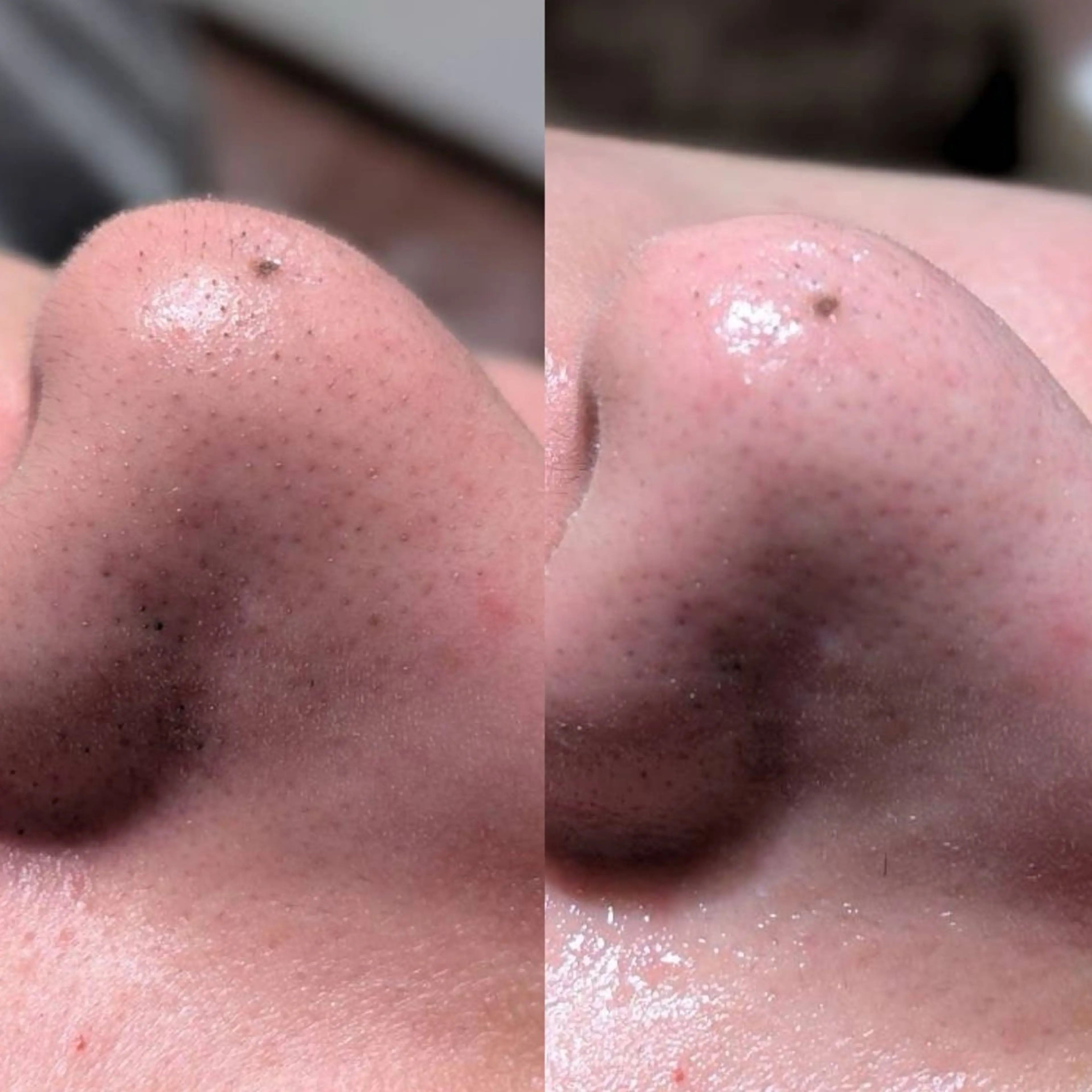 エステ 【Morphome】 ﾓﾙﾌｫﾑのエステ・リラクイメージ