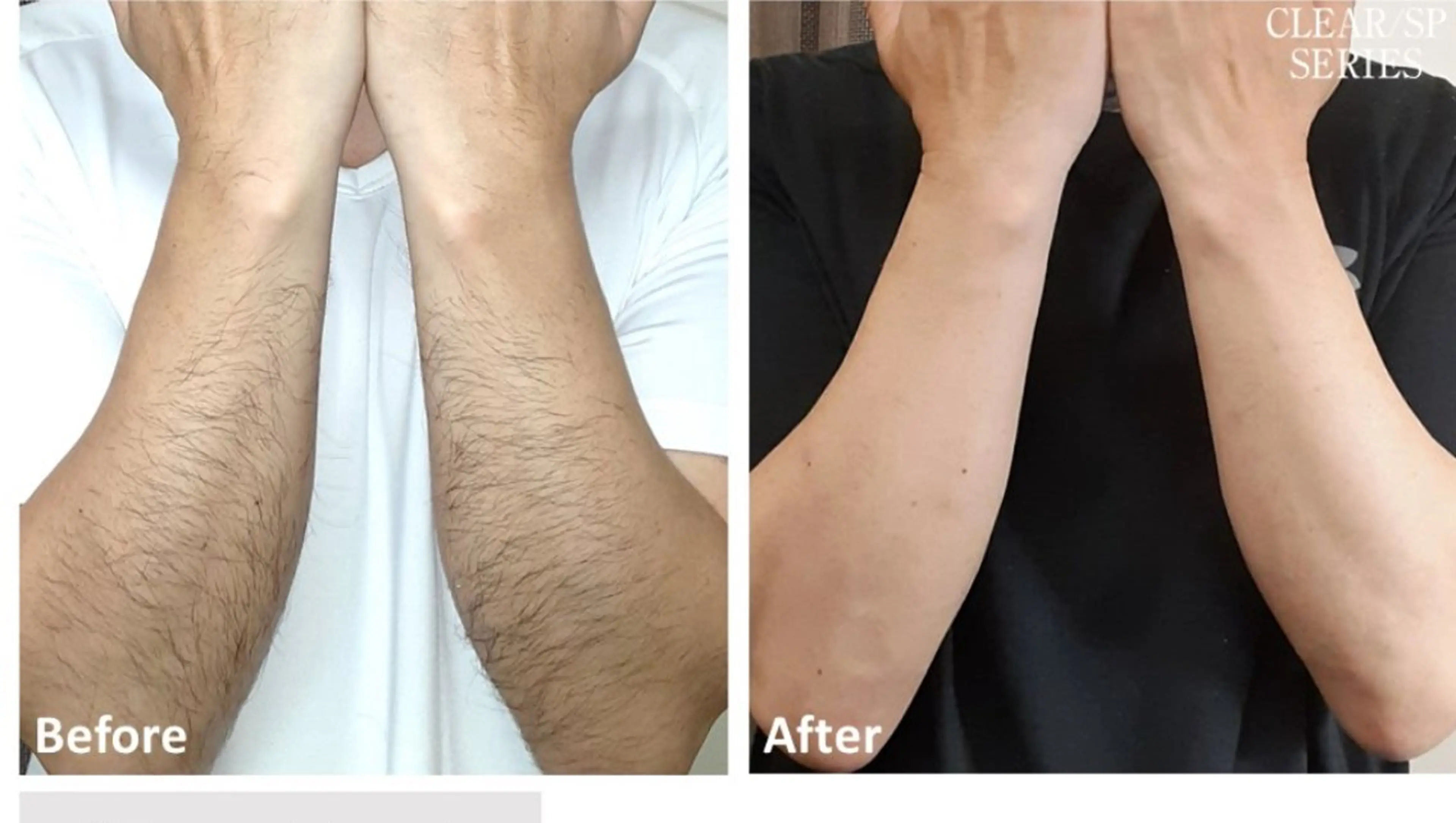 選べる部位３カ所セットの写真