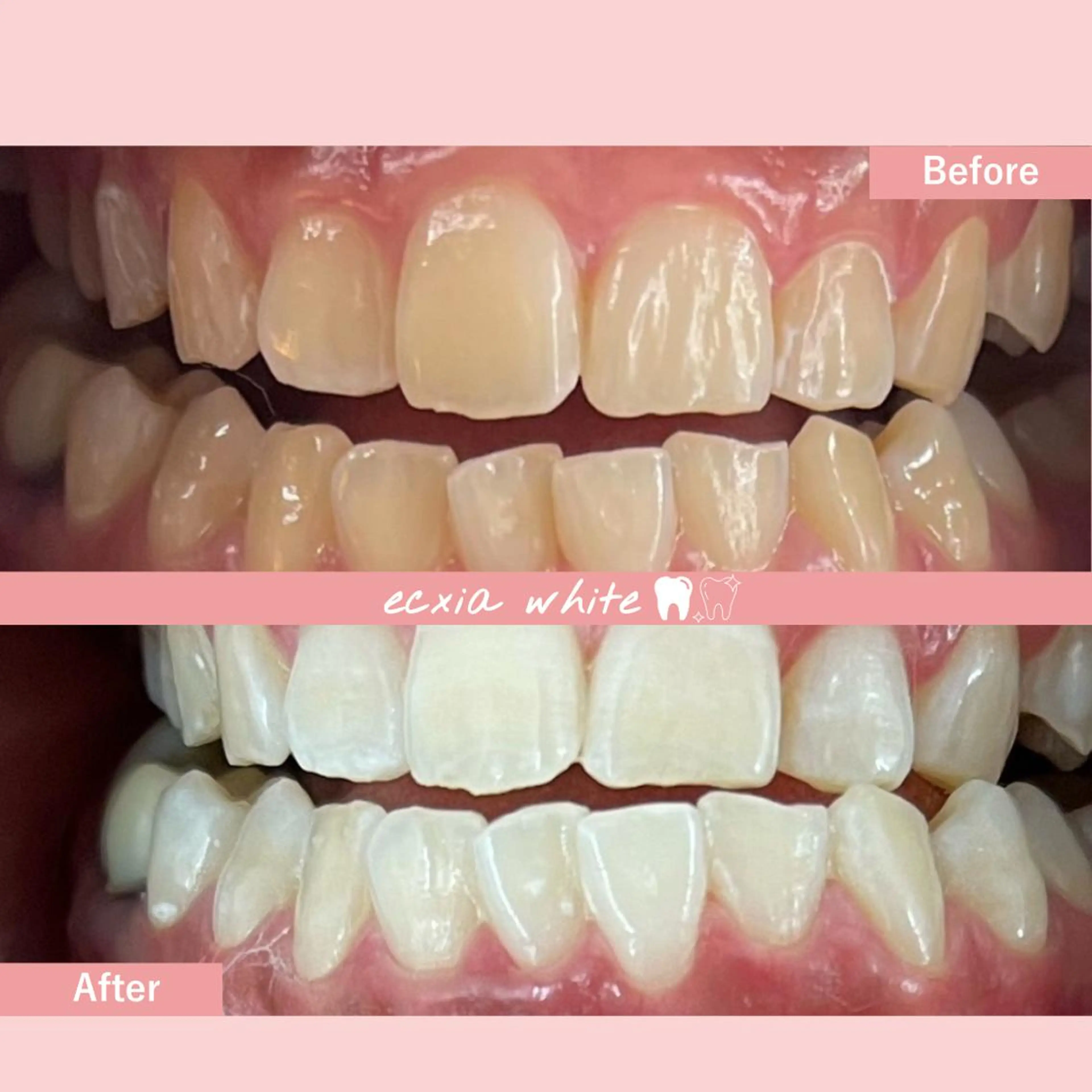 セルフホワイトニング エクシア中島公園店のその他イメージ