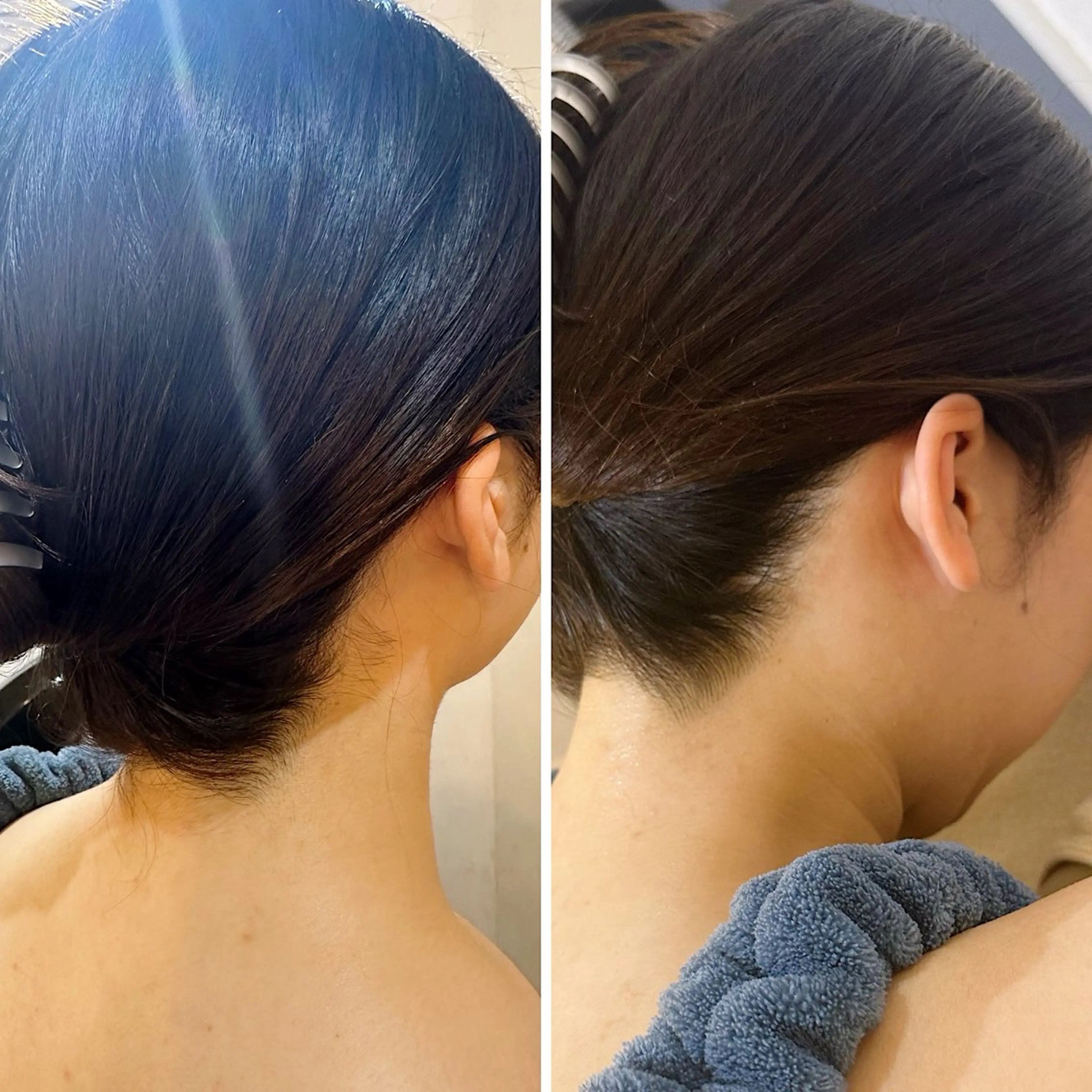 脱毛 うなじ脱毛/美肌脱毛 LABELのエステ・リラクイメージ