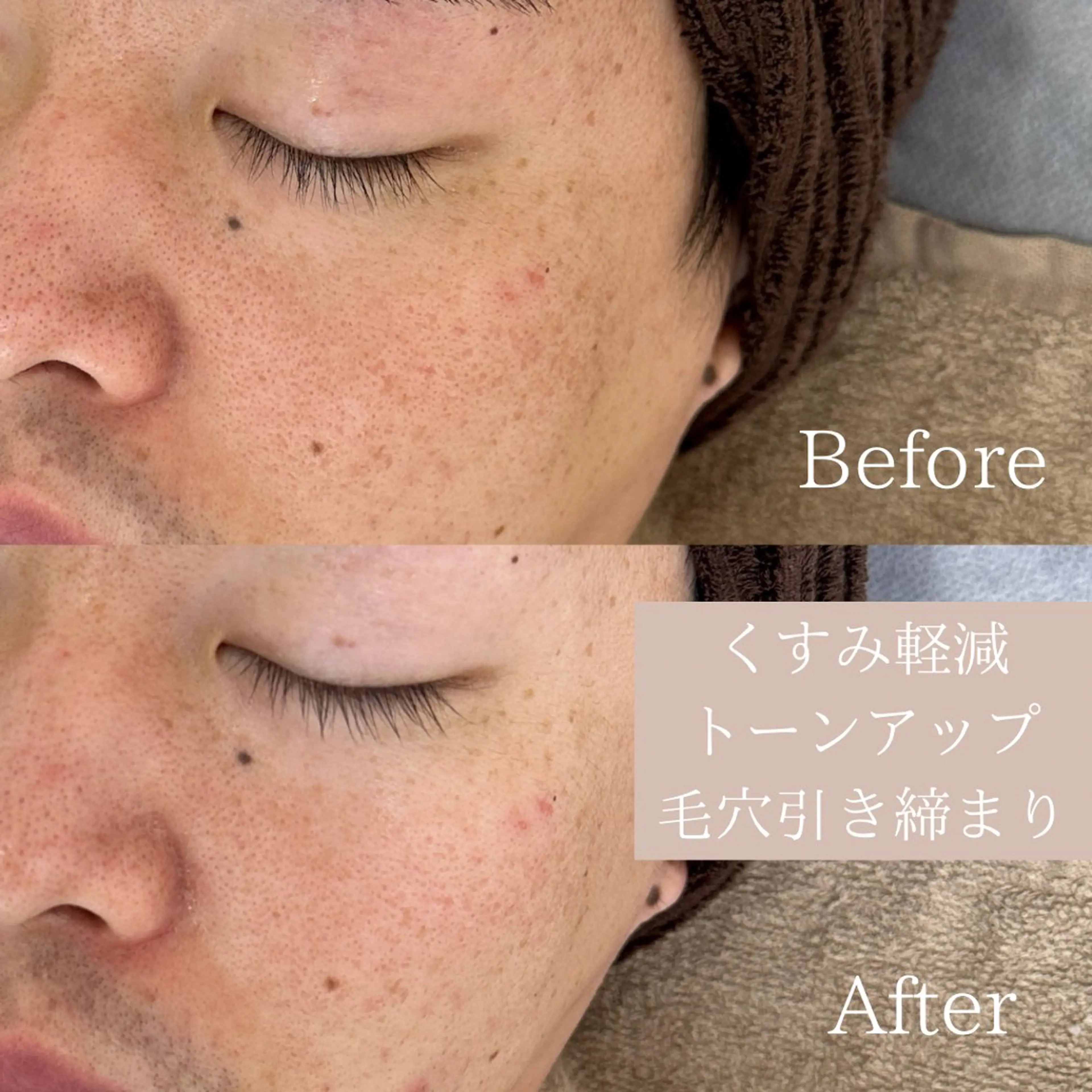 エステ lafleur Yurinaのエステ・リラクイメージ