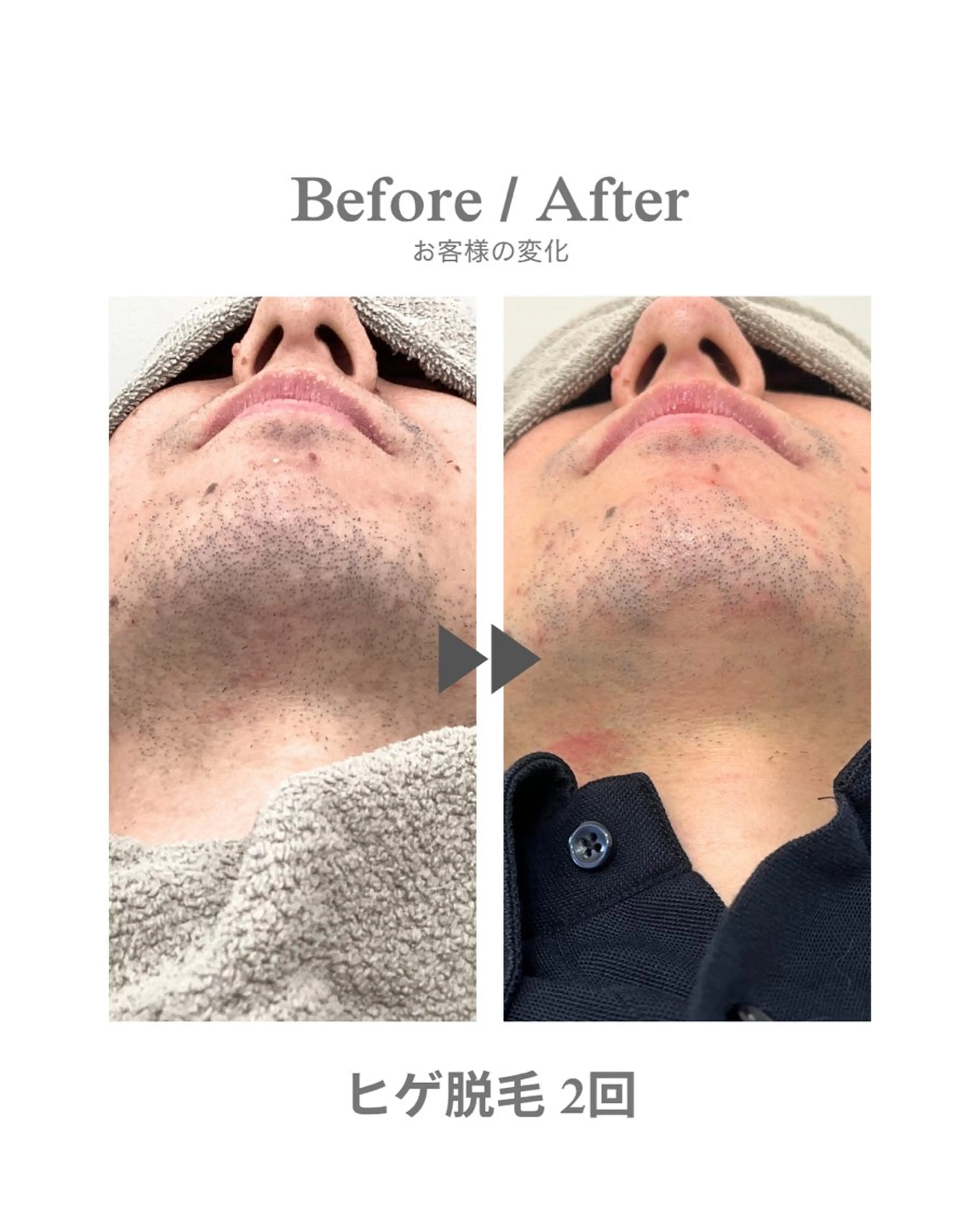 メンズ 脱毛 脱毛＆痩身エステ Narcisのエステ・リラクイメージ