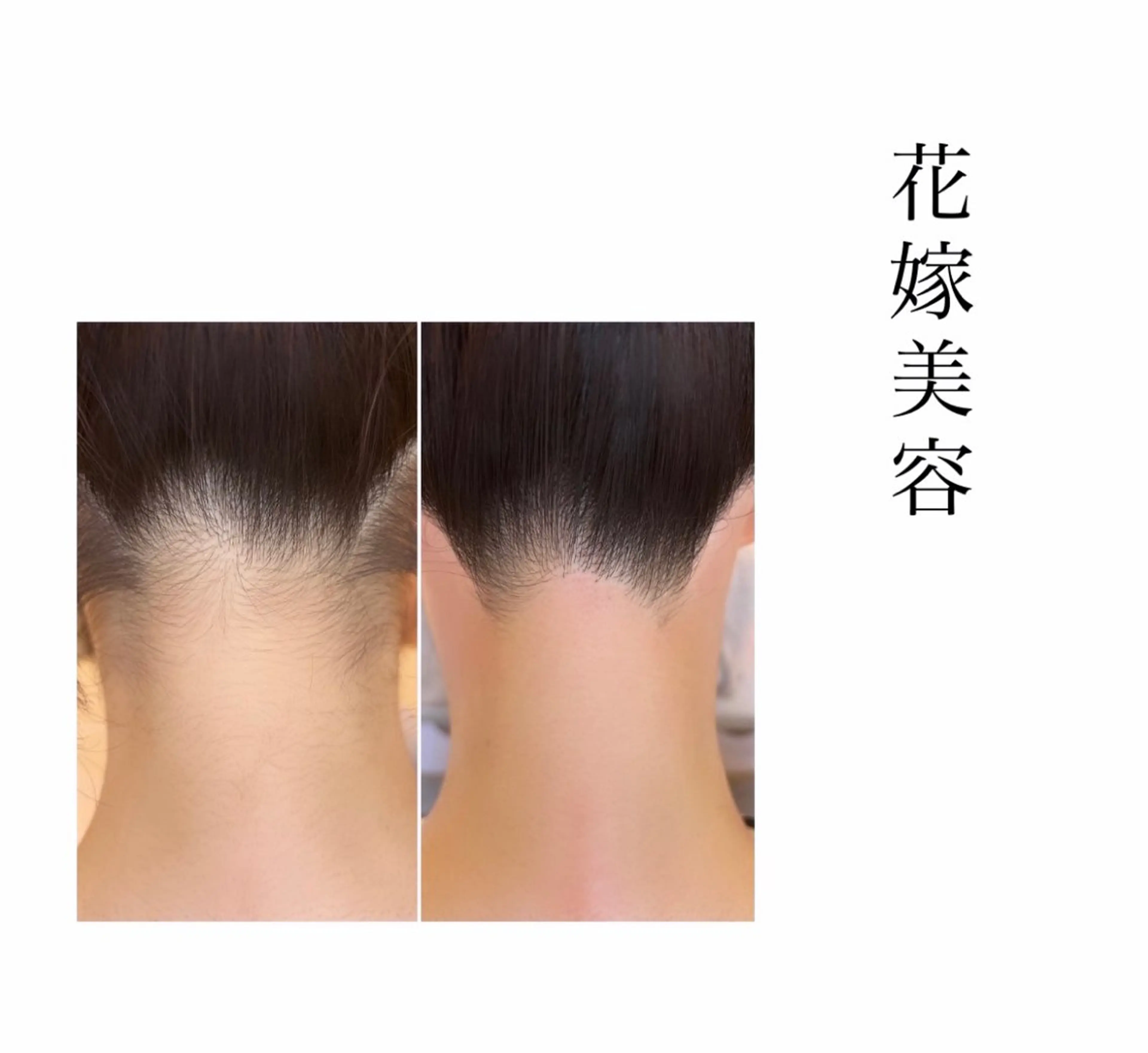 ヘアアレンジ ワックス脱毛🌈 ESPOIRnocoのエステ・リラクイメージ