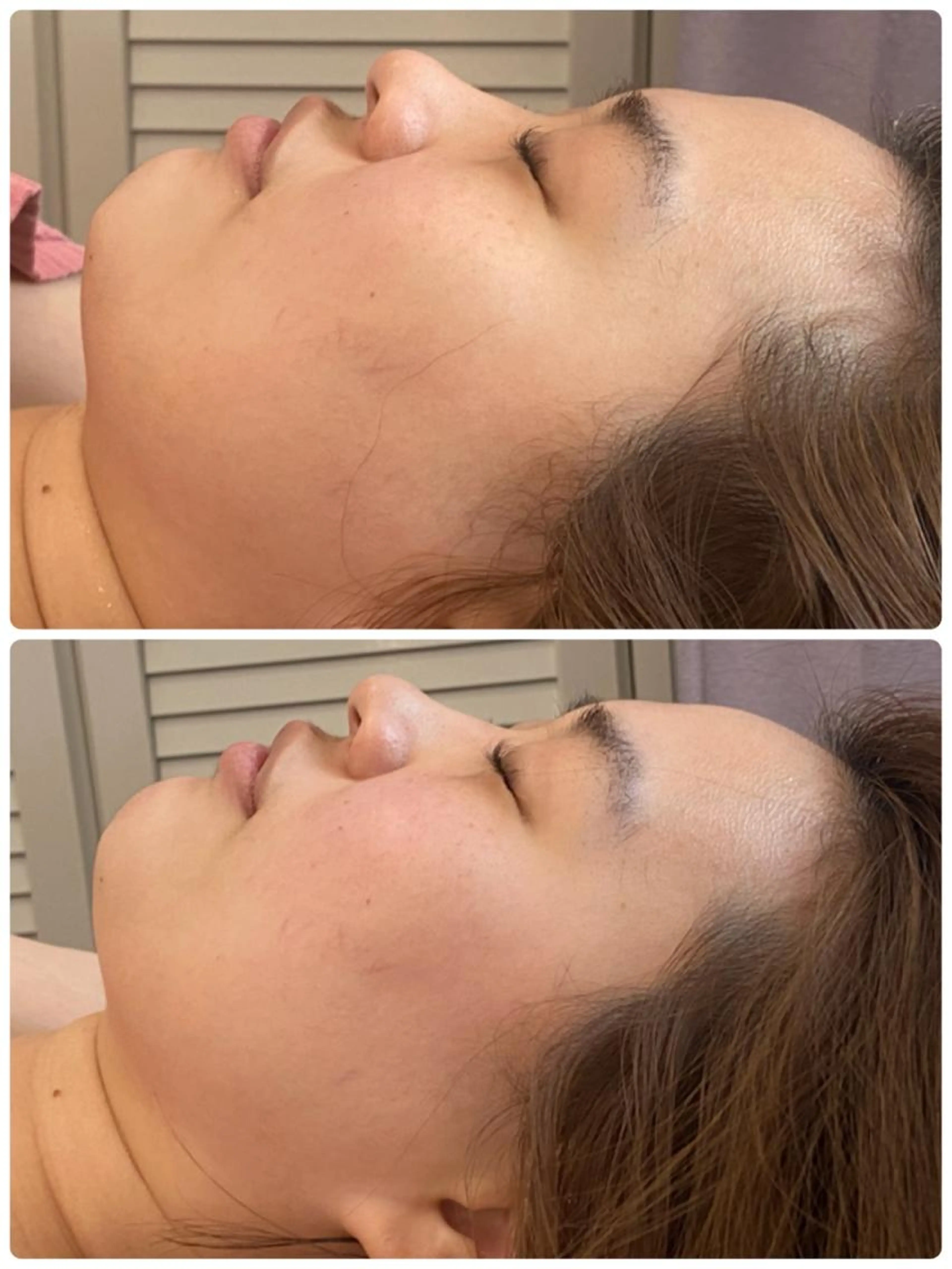 [小顔整体]フェイシャルエステ⭐︎小顔マッサージ💆コルギ以上...♪*ﾟ美容鍼以上の小顔！の写真