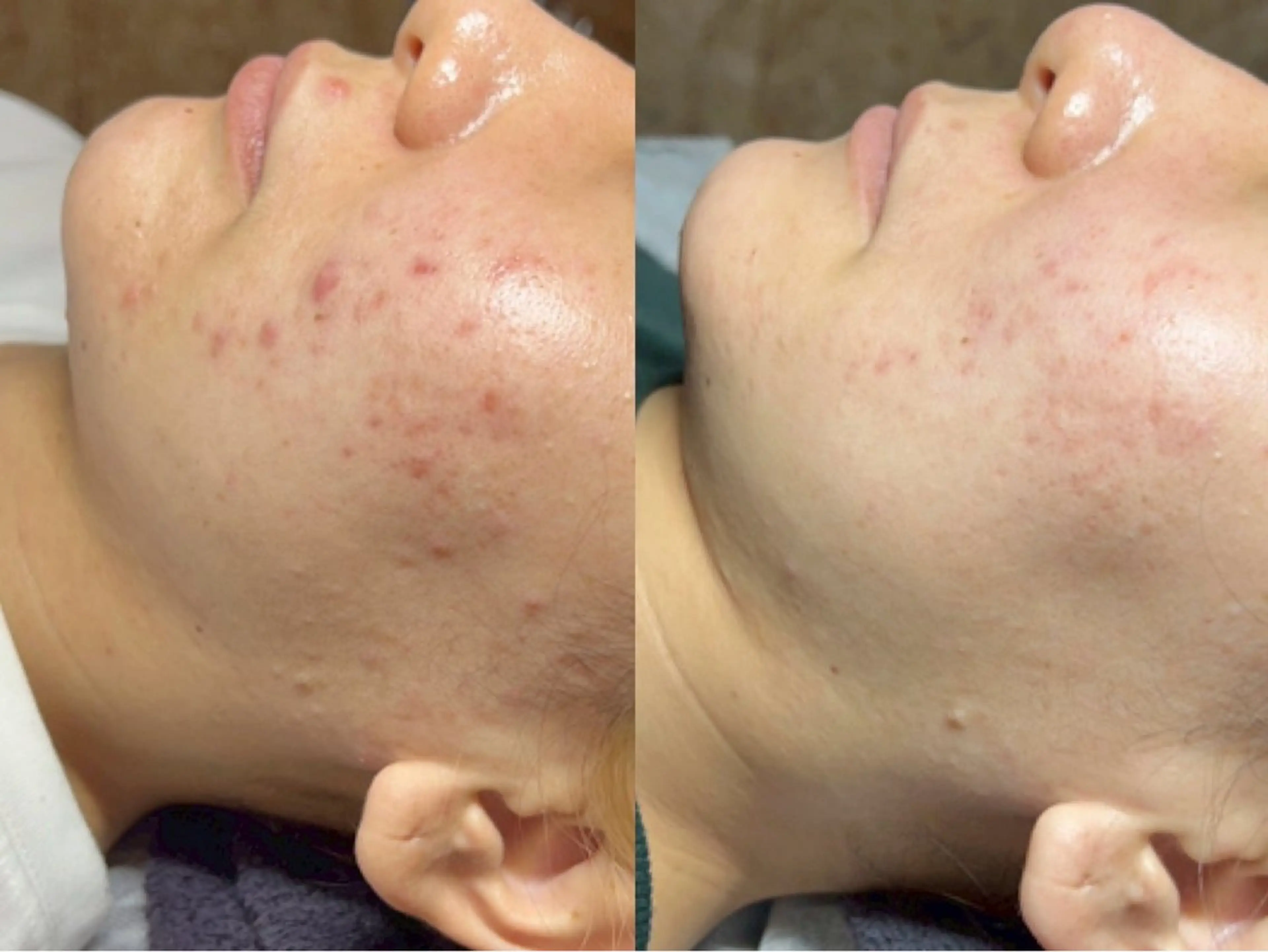 エステ ニキビ・毛穴・肌荒れ &me 西宮北口店のその他イメージ