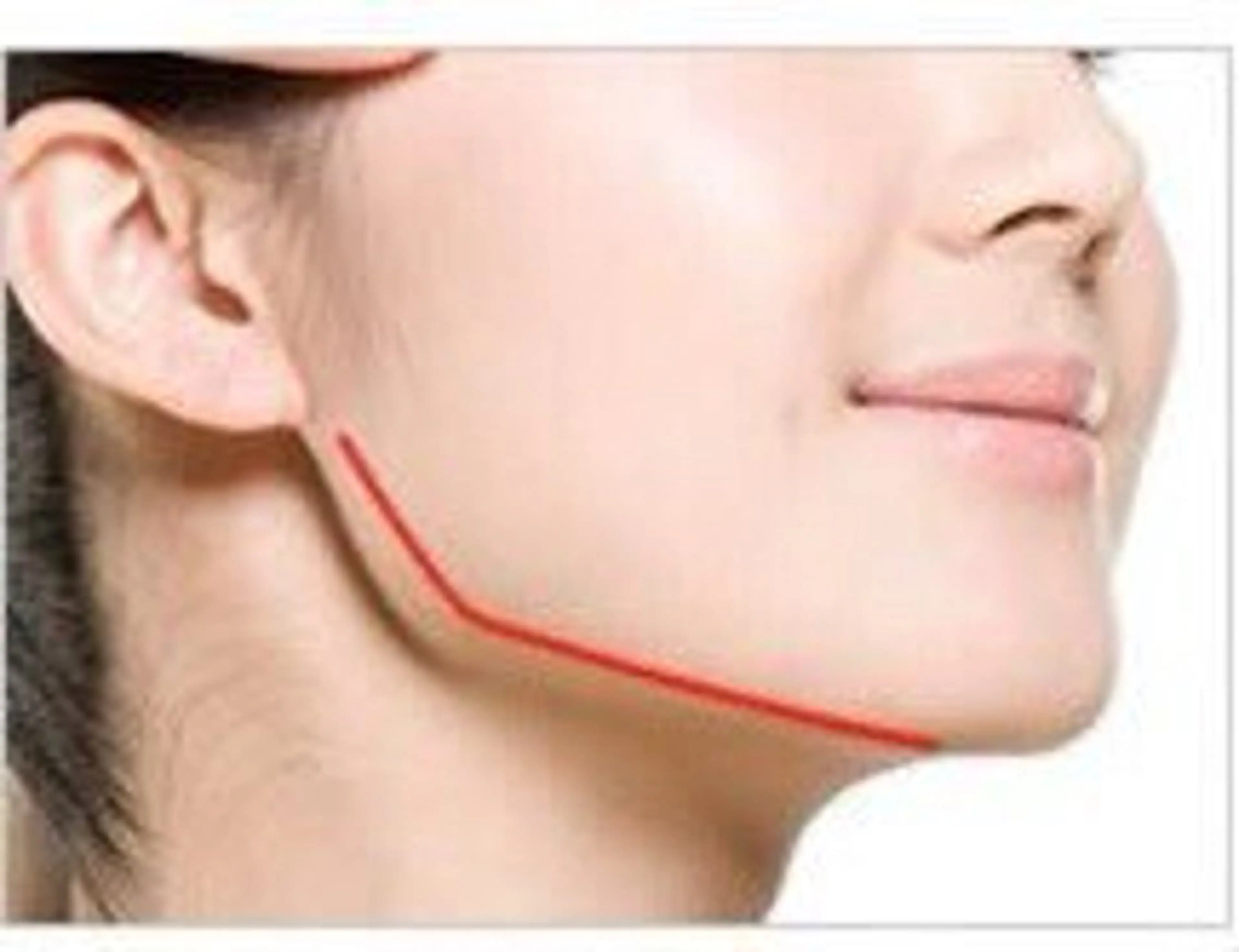 四角からＶライン小顔🦊✨【エラ張り食いしばり原因】小顔矯正＋エラほぐし/特にエラが気になる方へ/初回限定5,500円の写真