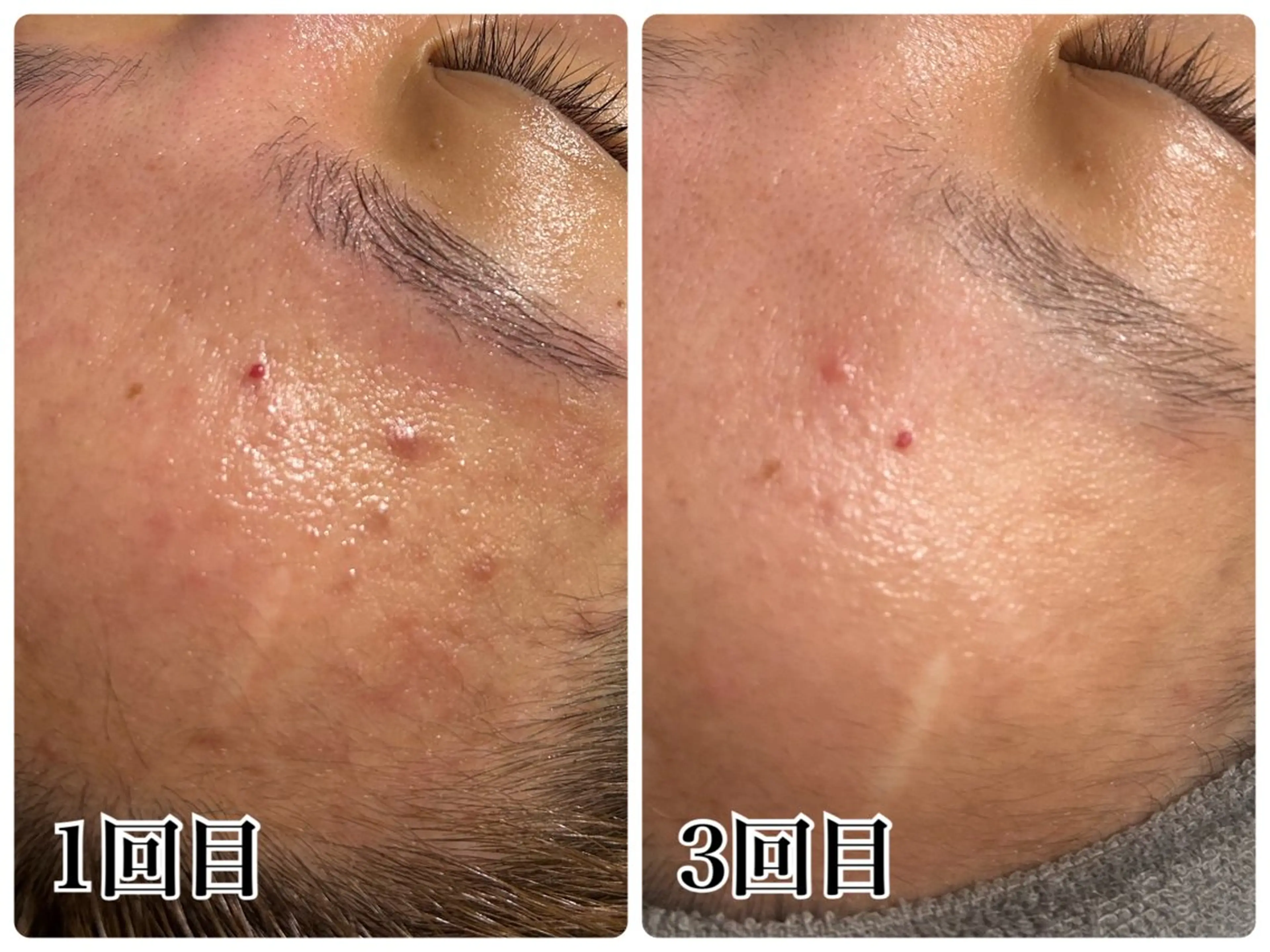 エステ Gemini 　MIKIのエステ・リラクイメージ