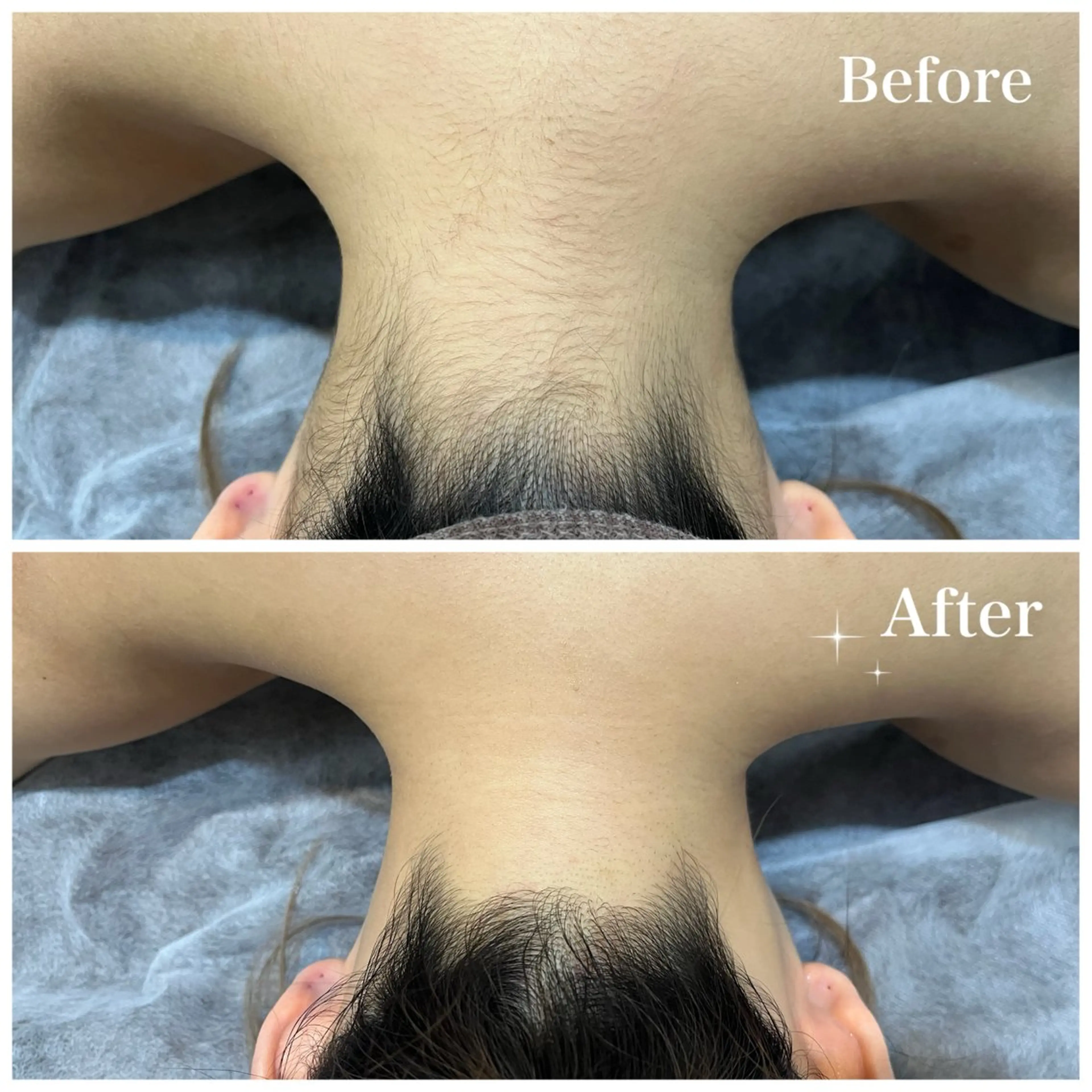 脱毛 脱毛サロン fam.豊澤柚良のエステ・リラクイメージ