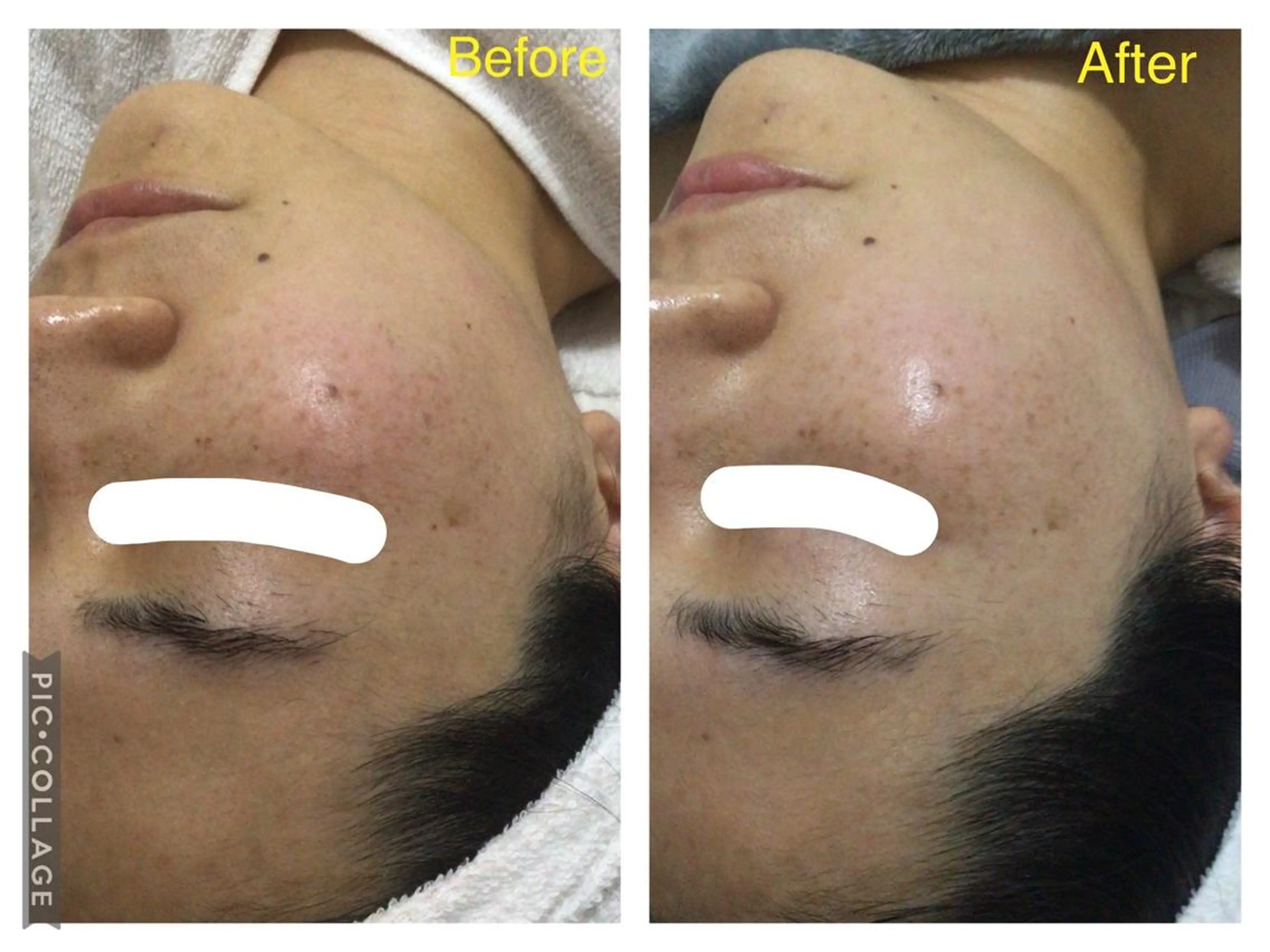 子宮矯正/腸揉み/ シュガーリング脱毛のエステ・リラクイメージ