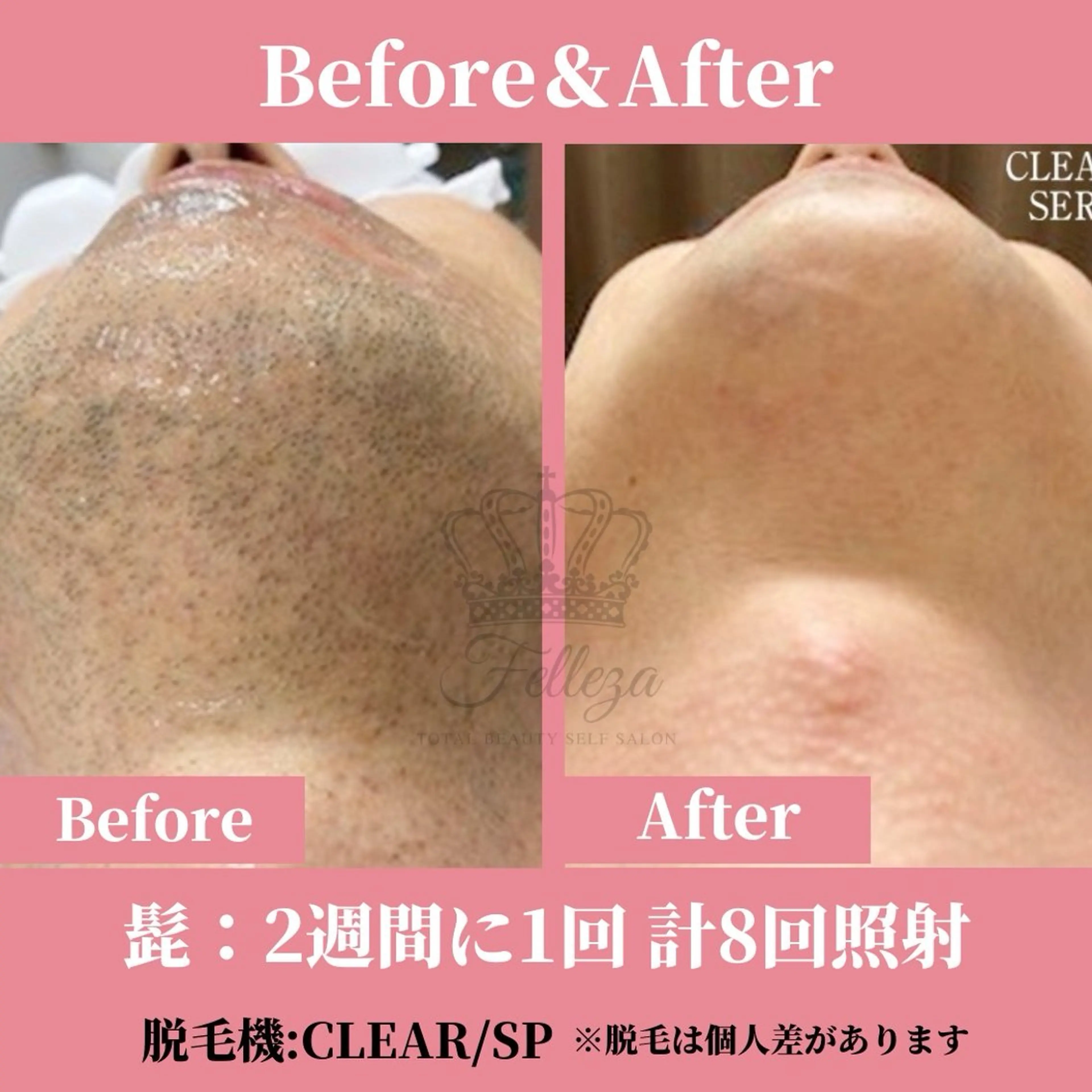 メンズ 有人型セルフサロン 脱毛／痩身／美顔のエステ・リラクイメージ