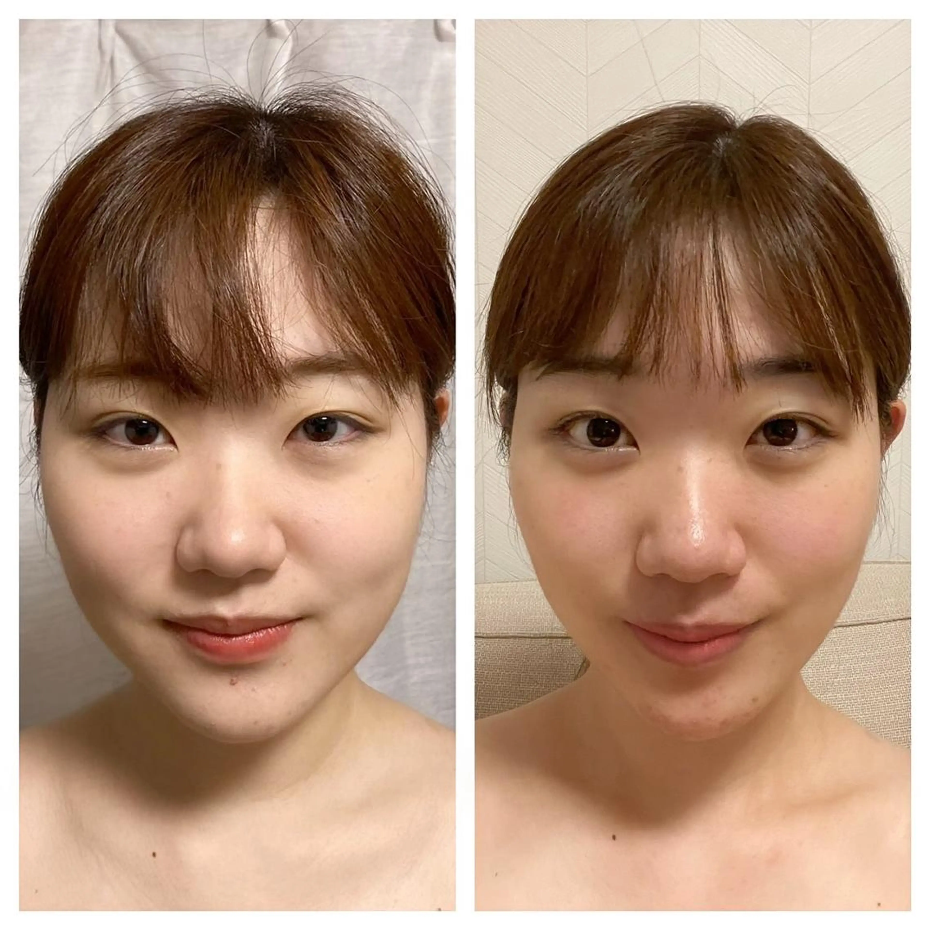 【お顔のむくみ・シミ・シワ・ホウレイ線の対策に】リンパフェイシャル６０分15000円→8000円の写真