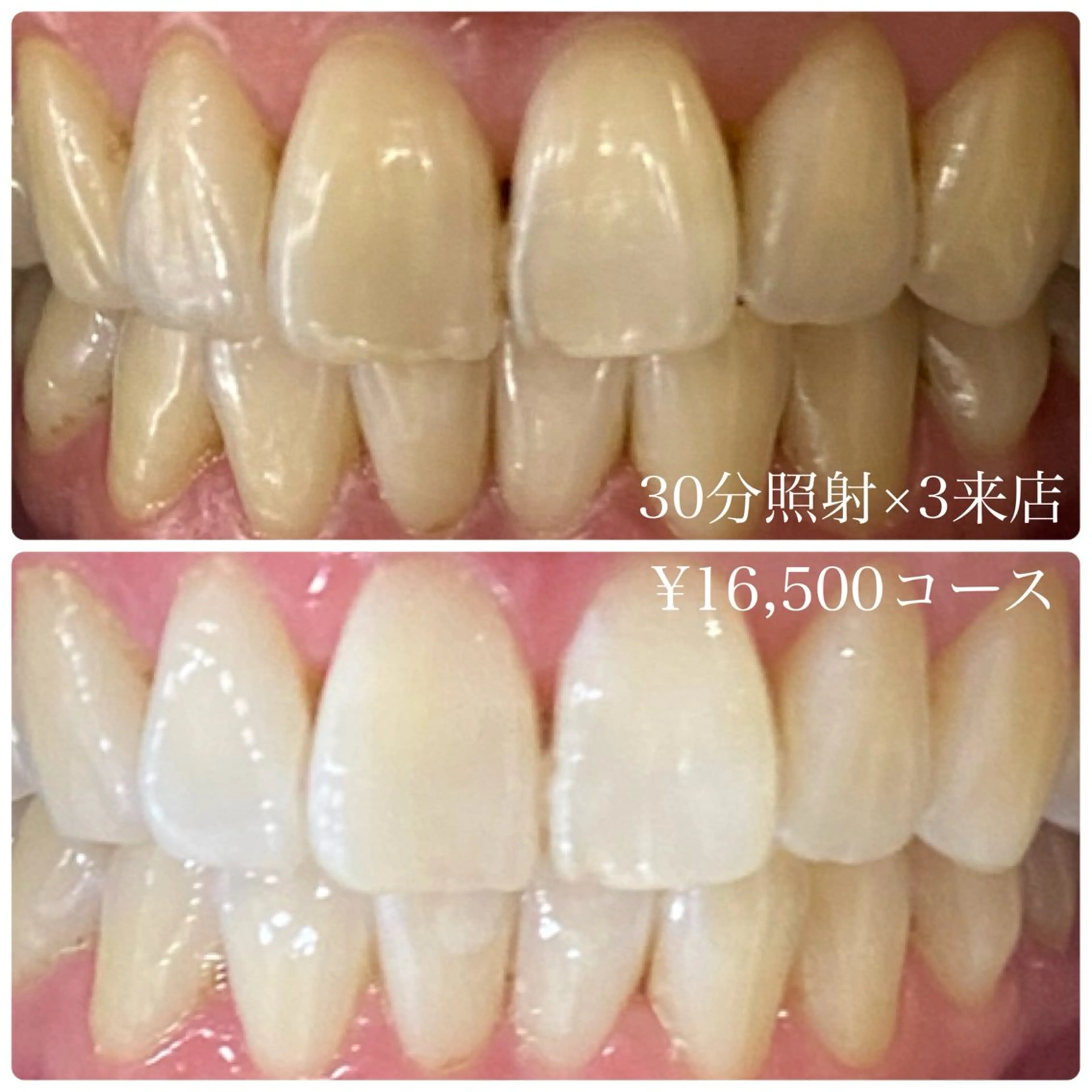 メンズ その他 ホワイトニングルーム　川崎店所属・ホワイトニング ルーム　川崎店のその他イメージ