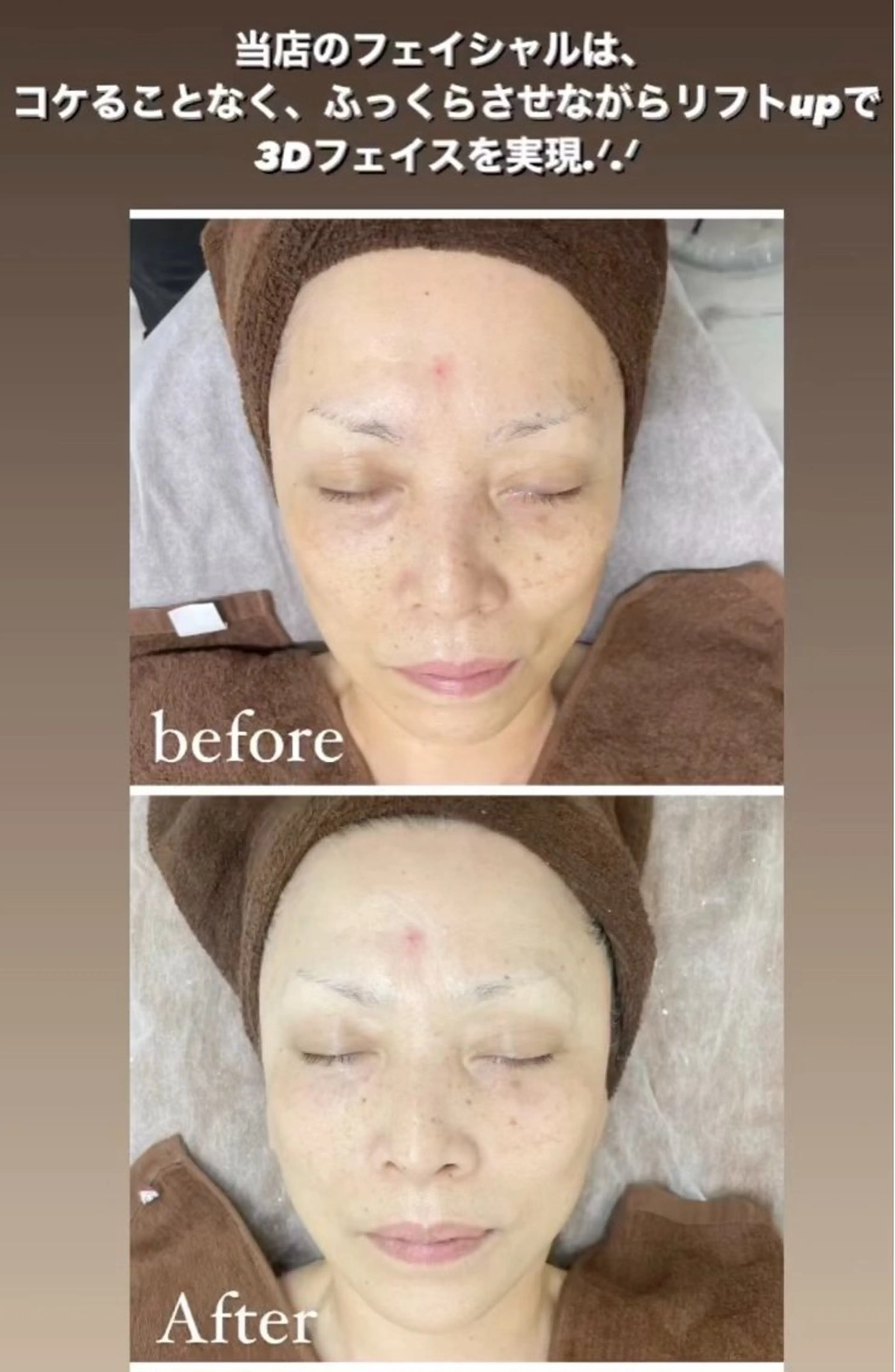 エステ レイエステティック スタッフのエステ・リラクイメージ