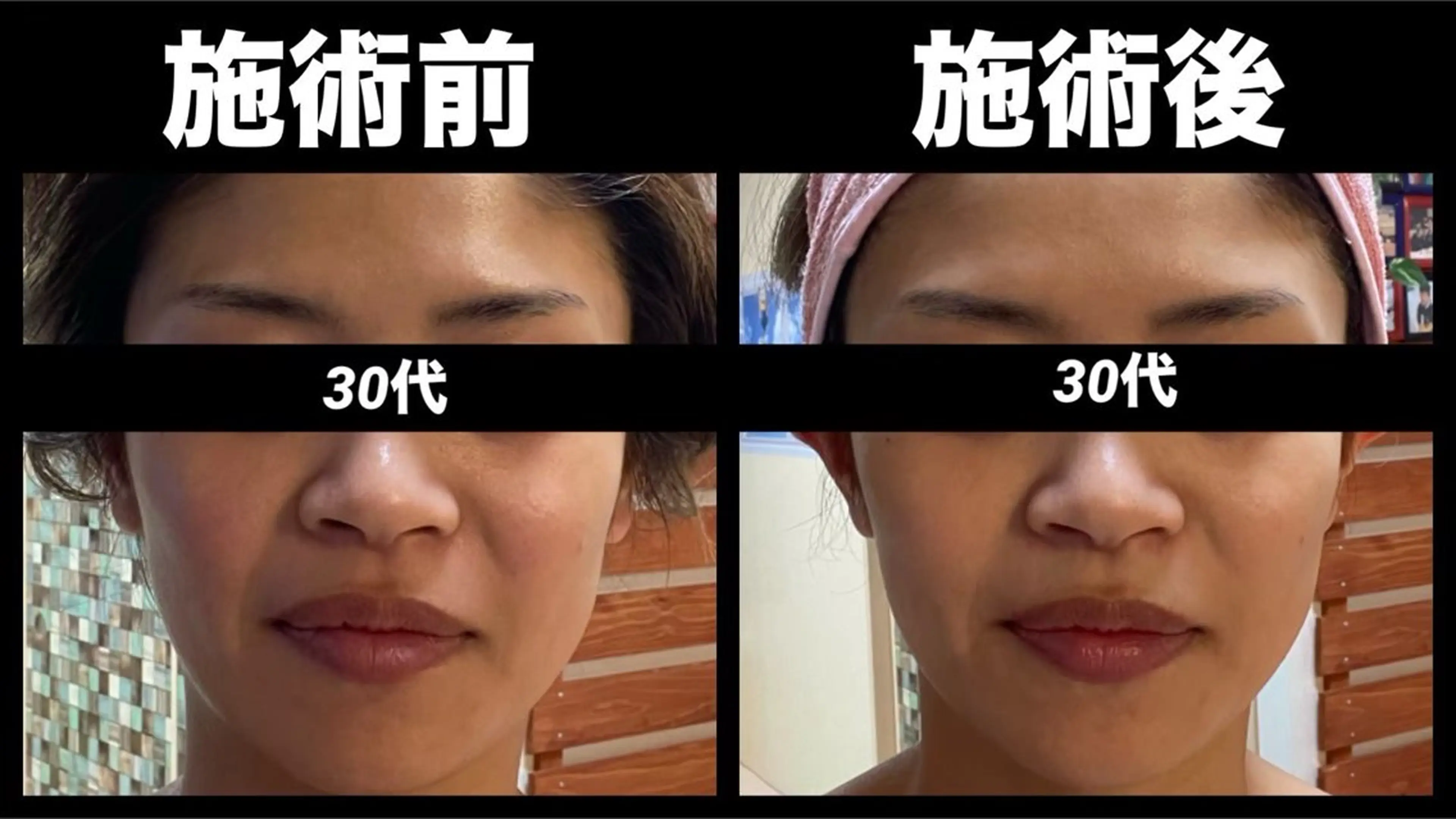 エステ リラク 夜サロン♡ Luana🦋.*˚のエステ・リラクイメージ