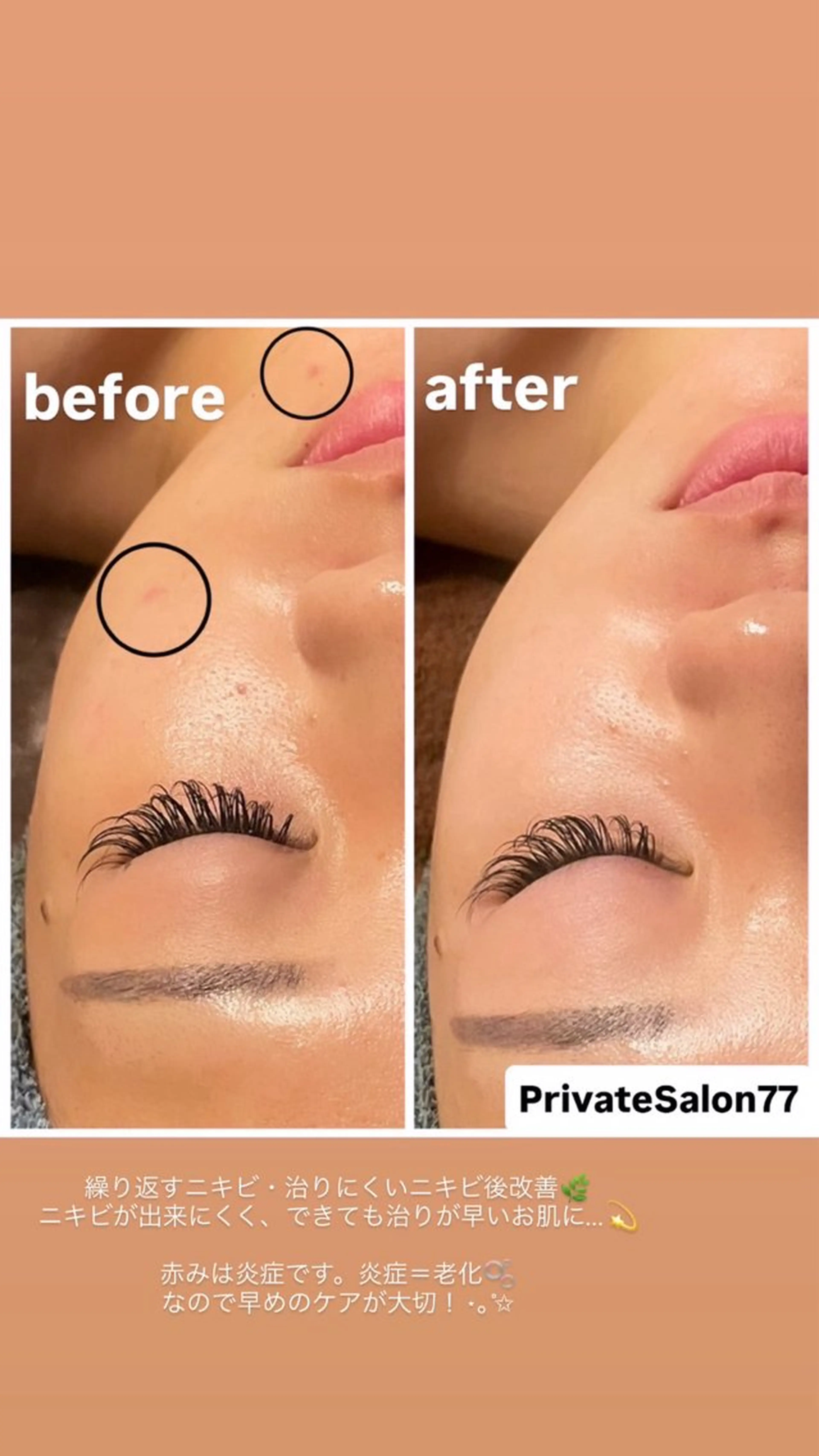 エステ リラク Private Salon77のエステ・リラクイメージ