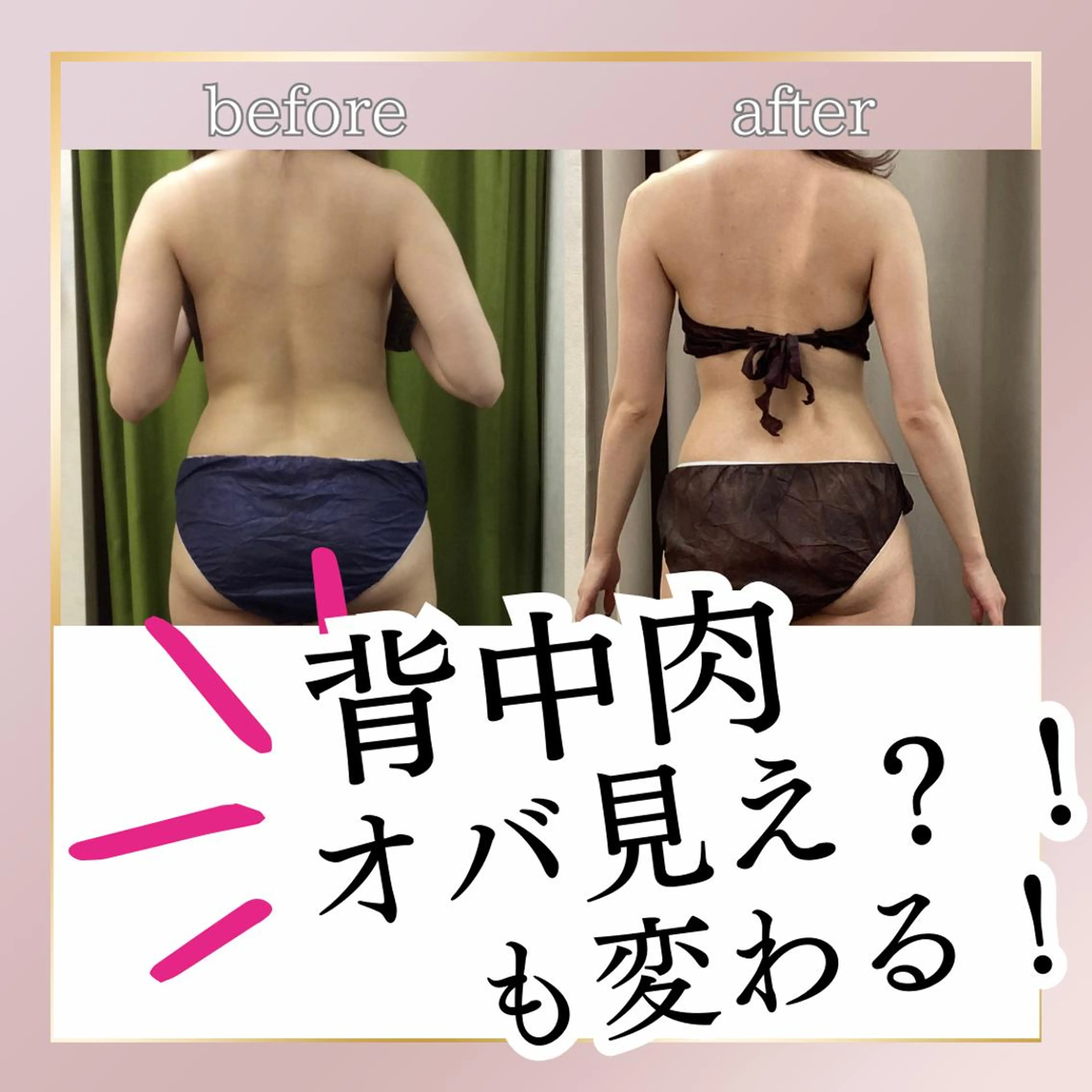 NON-NONプラス 大人の本気痩身のエステ・リラクイメージ