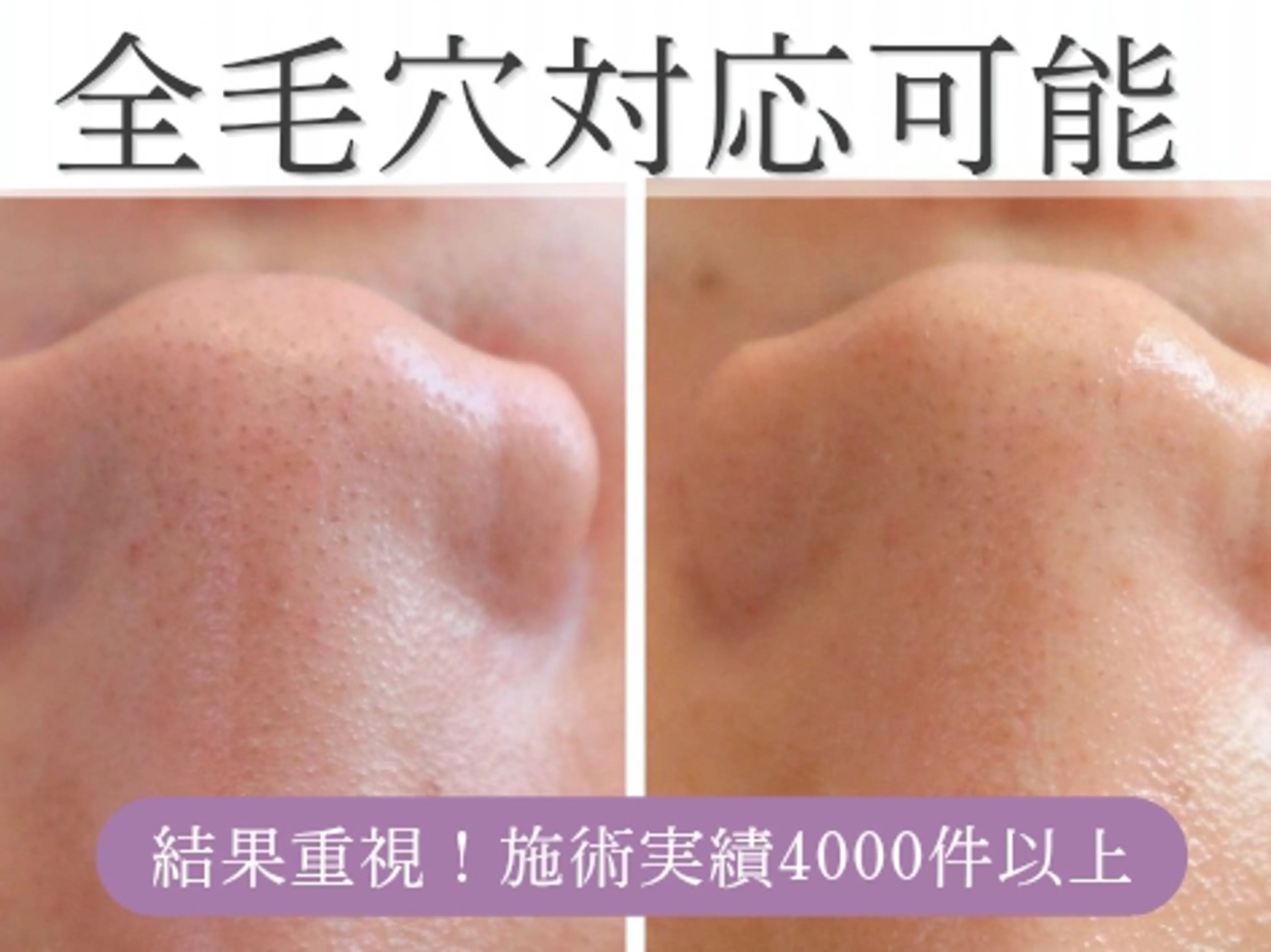 エステサロン NICOLIのエステ・リラクイメージ