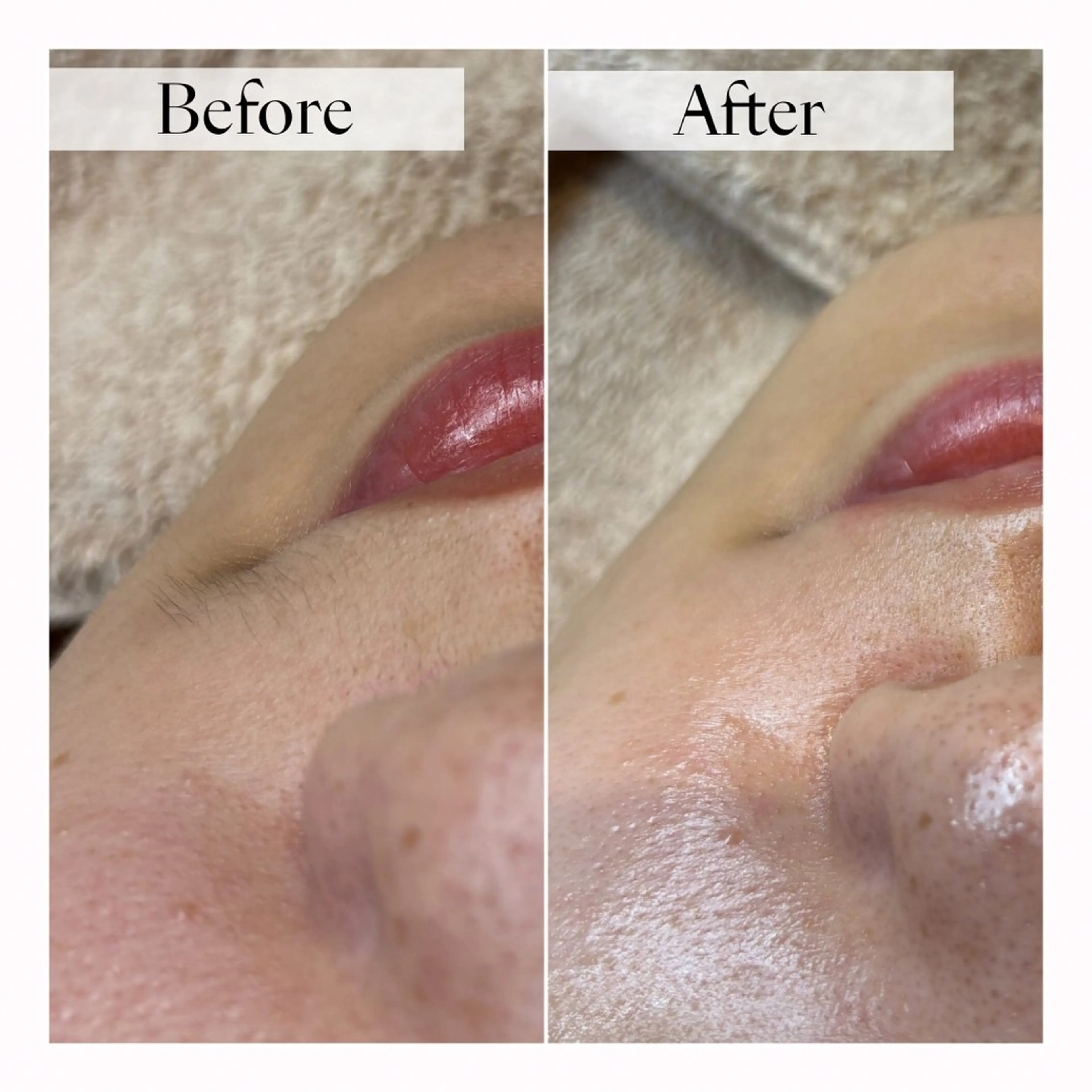 エステ 津村 夏実のエステ・リラクイメージ