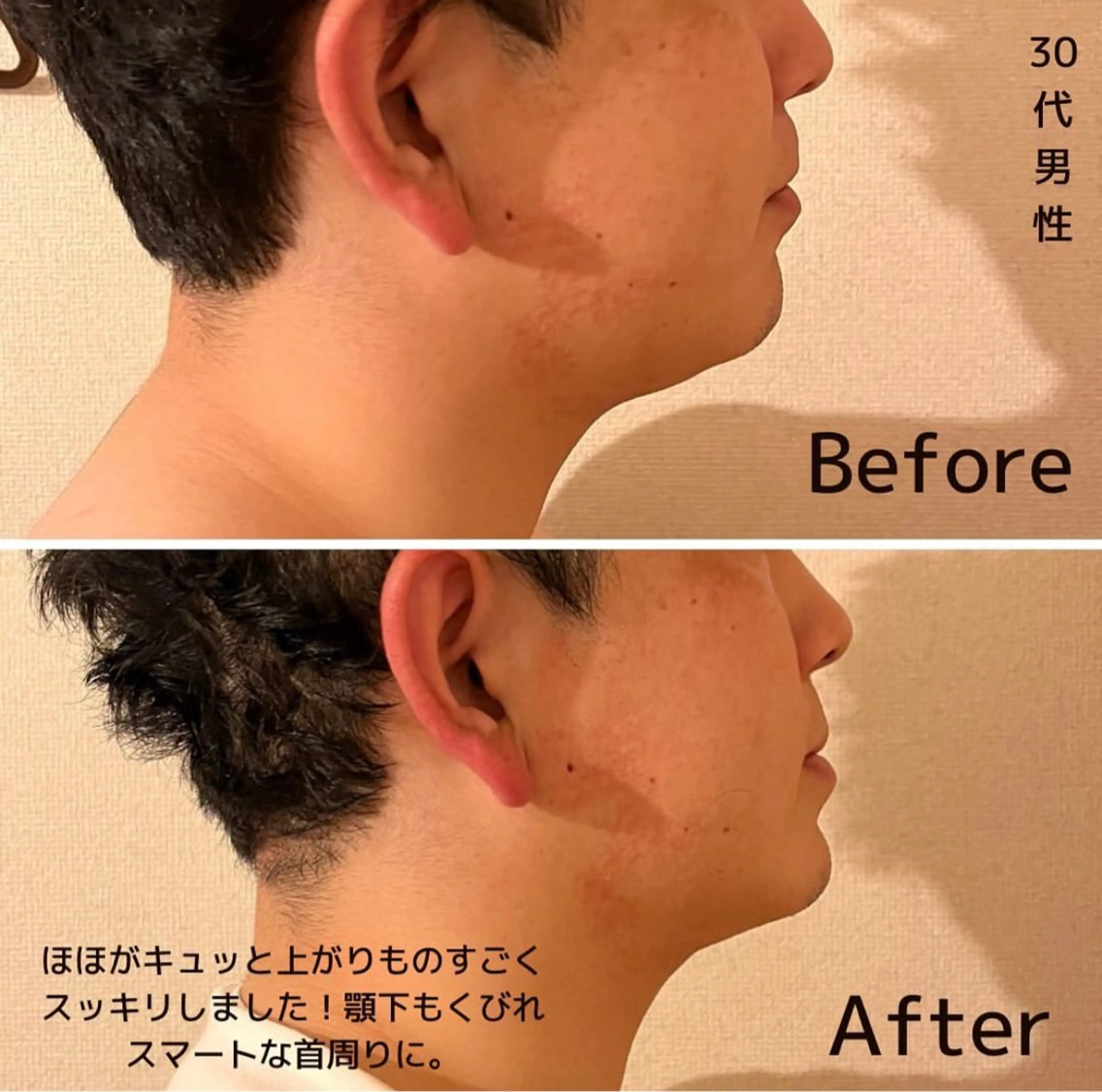 エステ リラク 表情筋フェイシャル 三軒茶屋のエステ・リラクイメージ