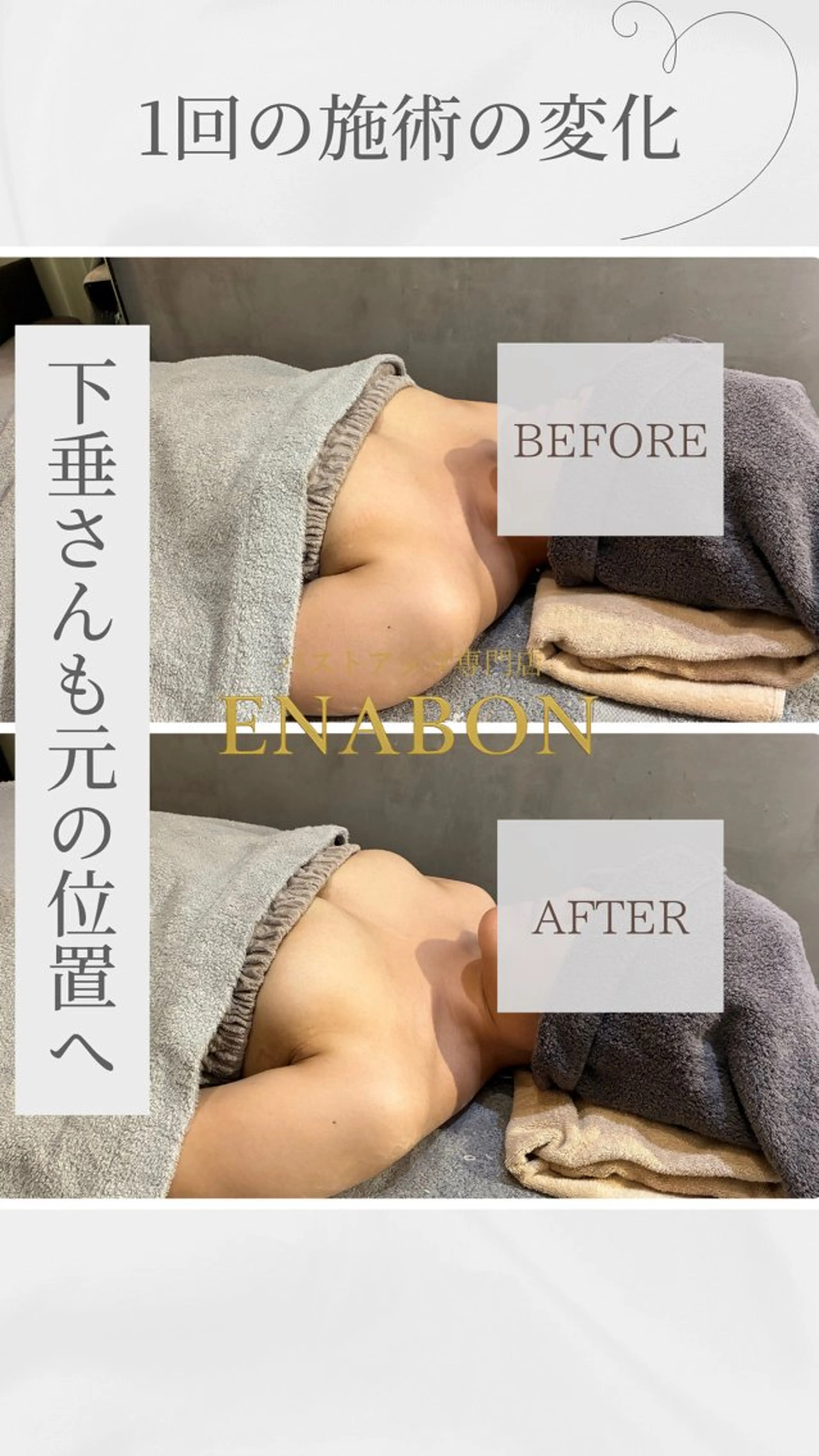 エステ ENABON所属・バストアップサロン ENABON  上野のエステ・リラクイメージ