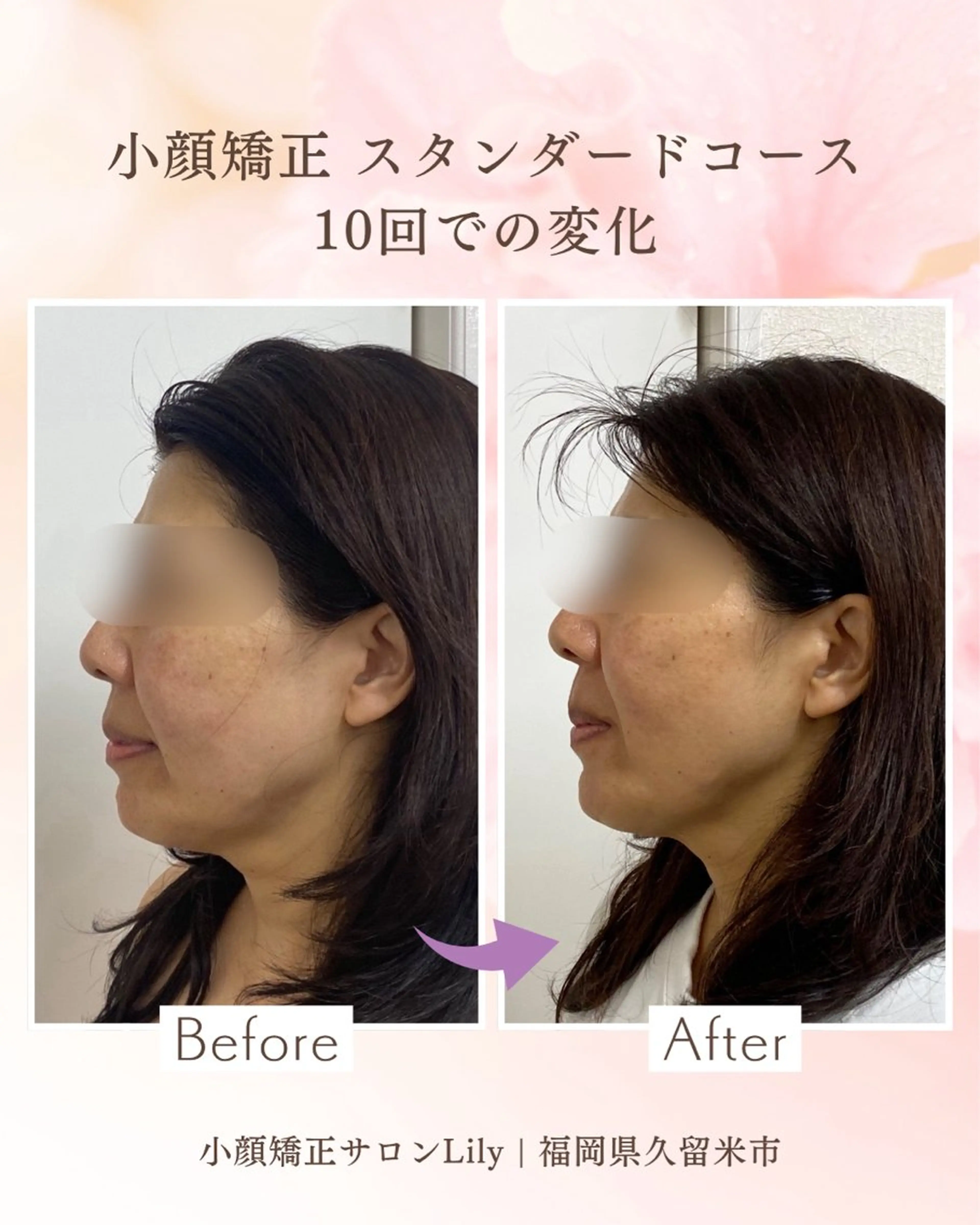 小顔矯正サロン Lilyのエステ・リラクイメージ