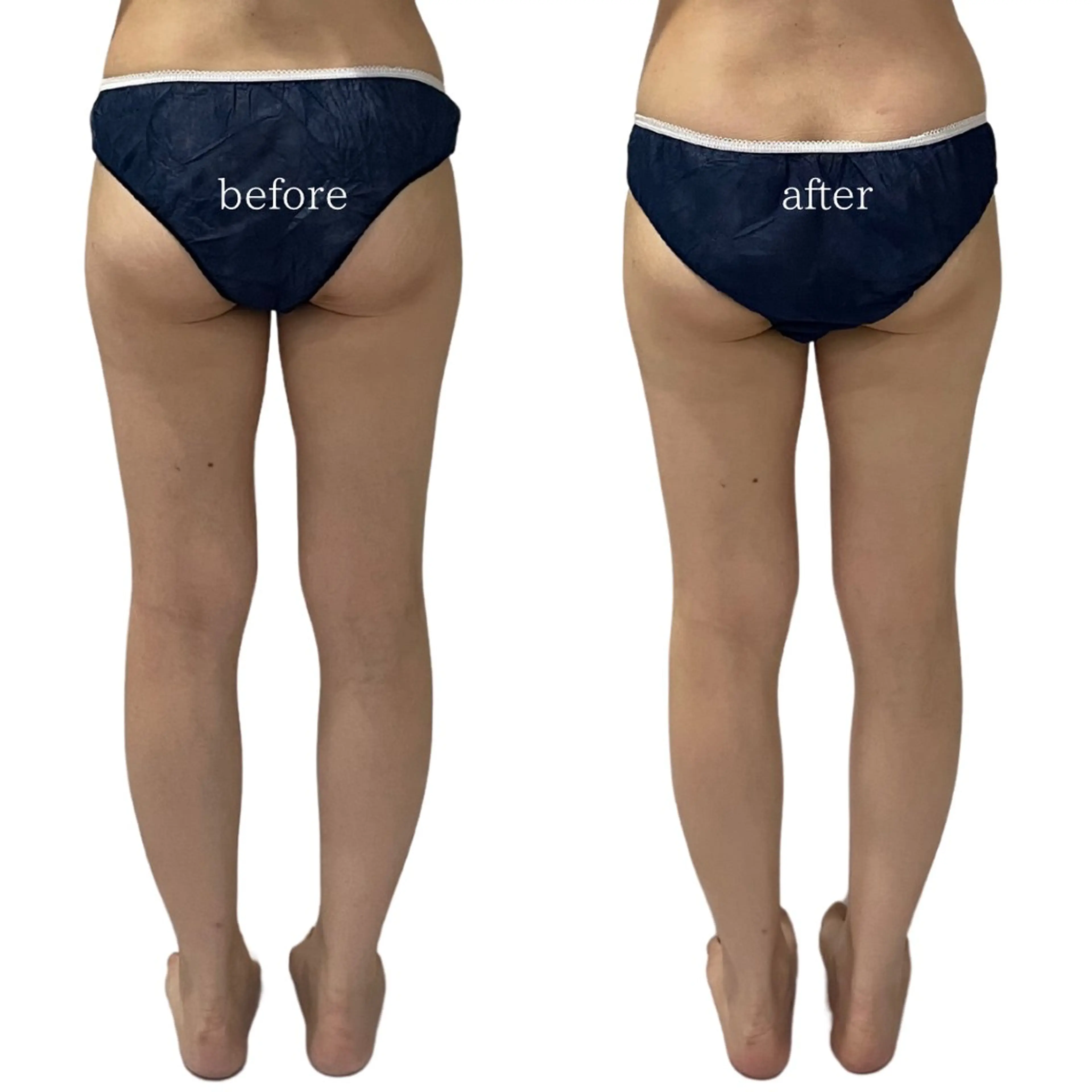 オフ:オン 全身筋膜マッサージのエステ・リラクイメージ