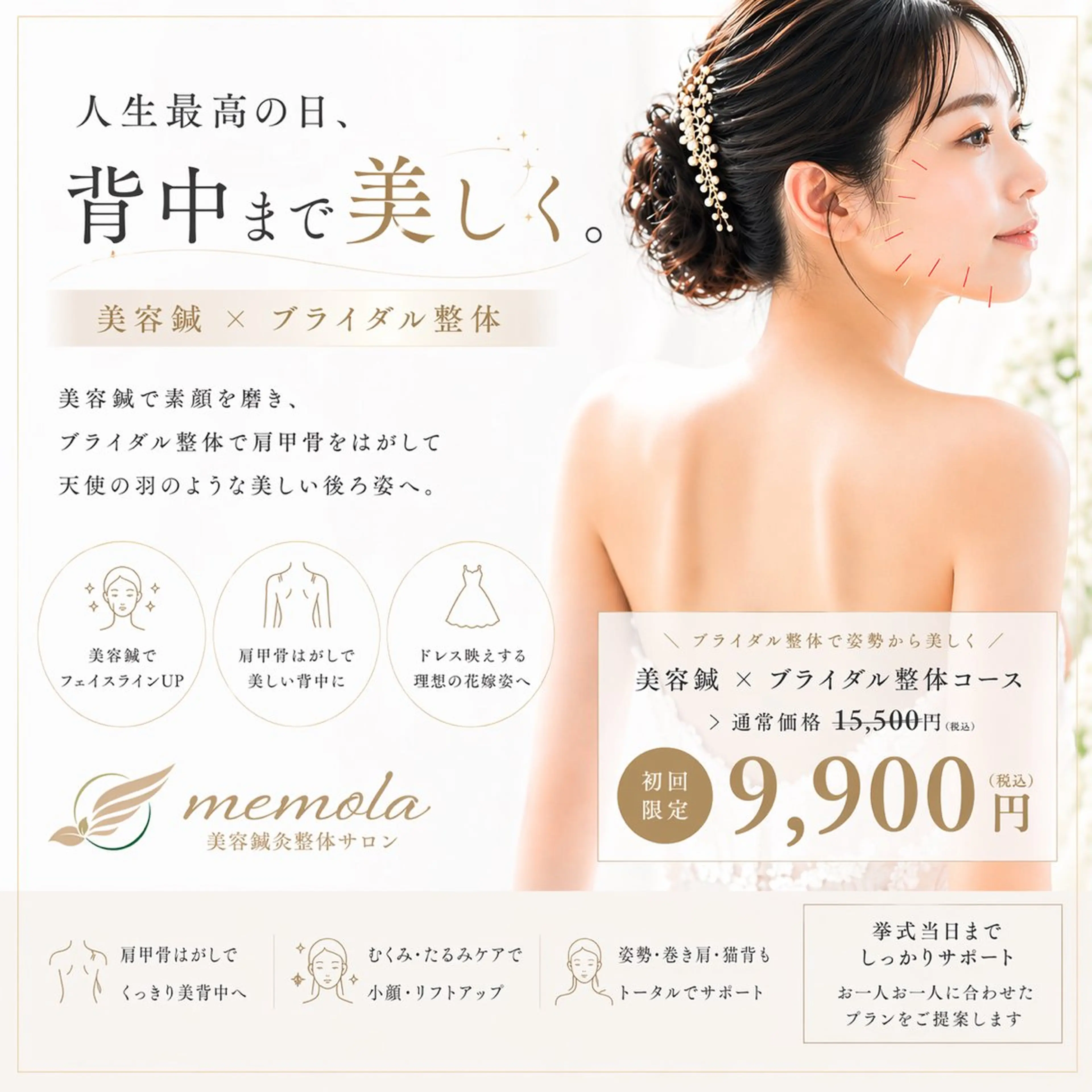 【プレ花嫁人気No.1】ブライダル整体×美容鍼(90分)（リフトアップ/小顔/肩甲骨はがし/姿勢矯正）の写真
