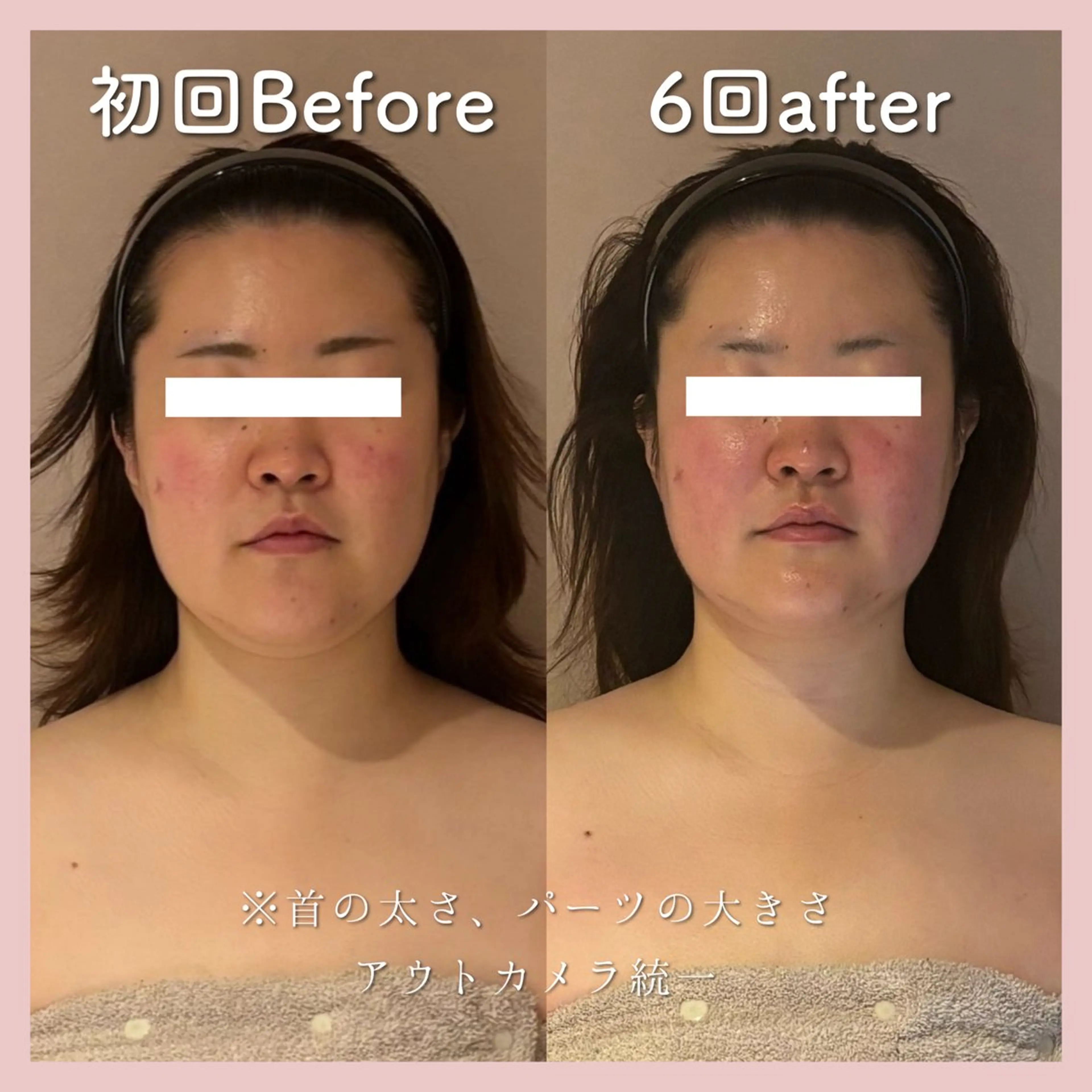 小顔矯正専門店Gémiey所属・越谷駅徒歩３分 小顔専門Gemieyのエステ・リラクイメージ