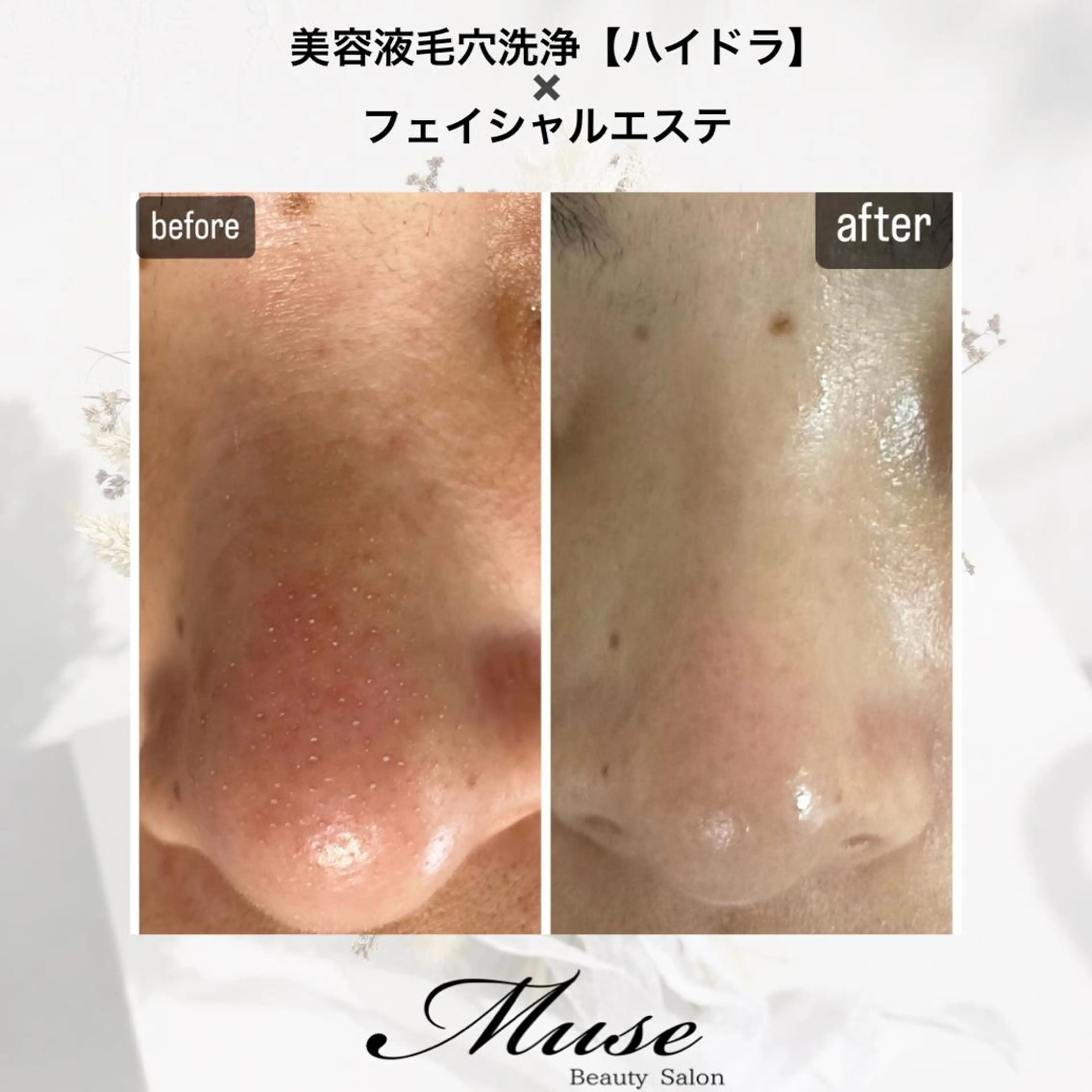 医療提携Beauty SalonMuseのエステ・リラクイメージ