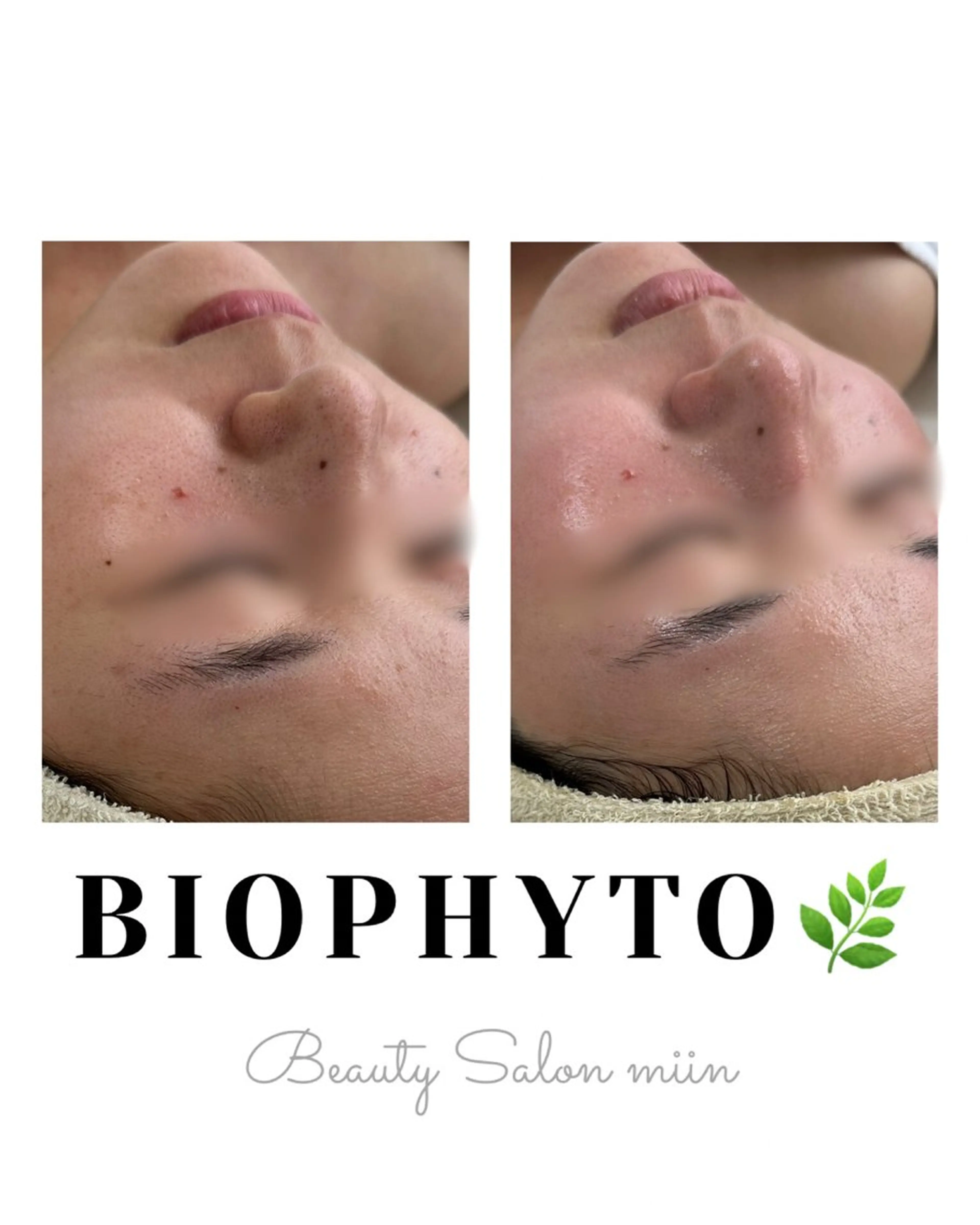 エステ 韓国肌管理 白玉肌管理®︎のエステ・リラクイメージ