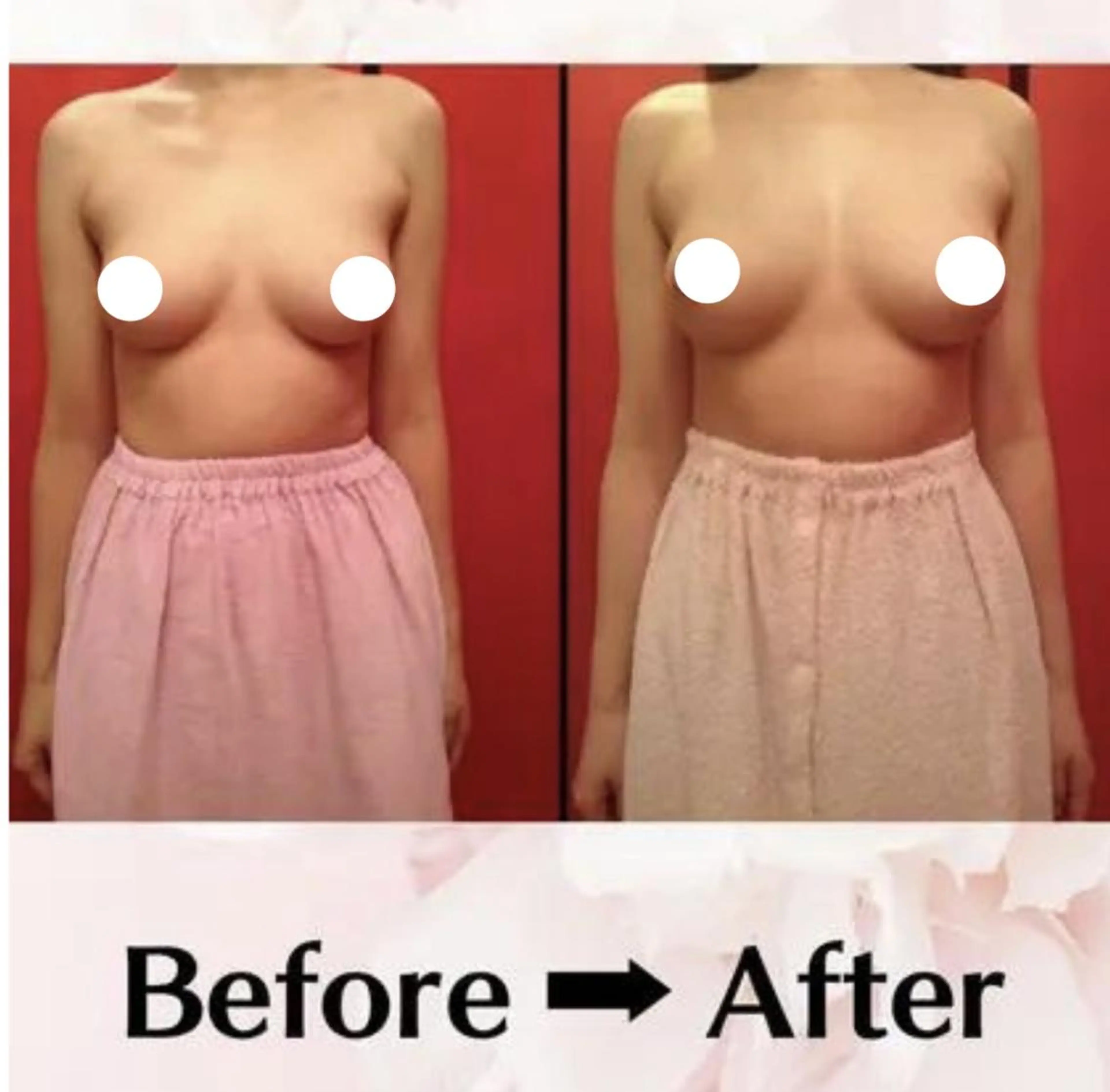 バスト・脱毛・痩身 上島のエステ・リラクイメージ