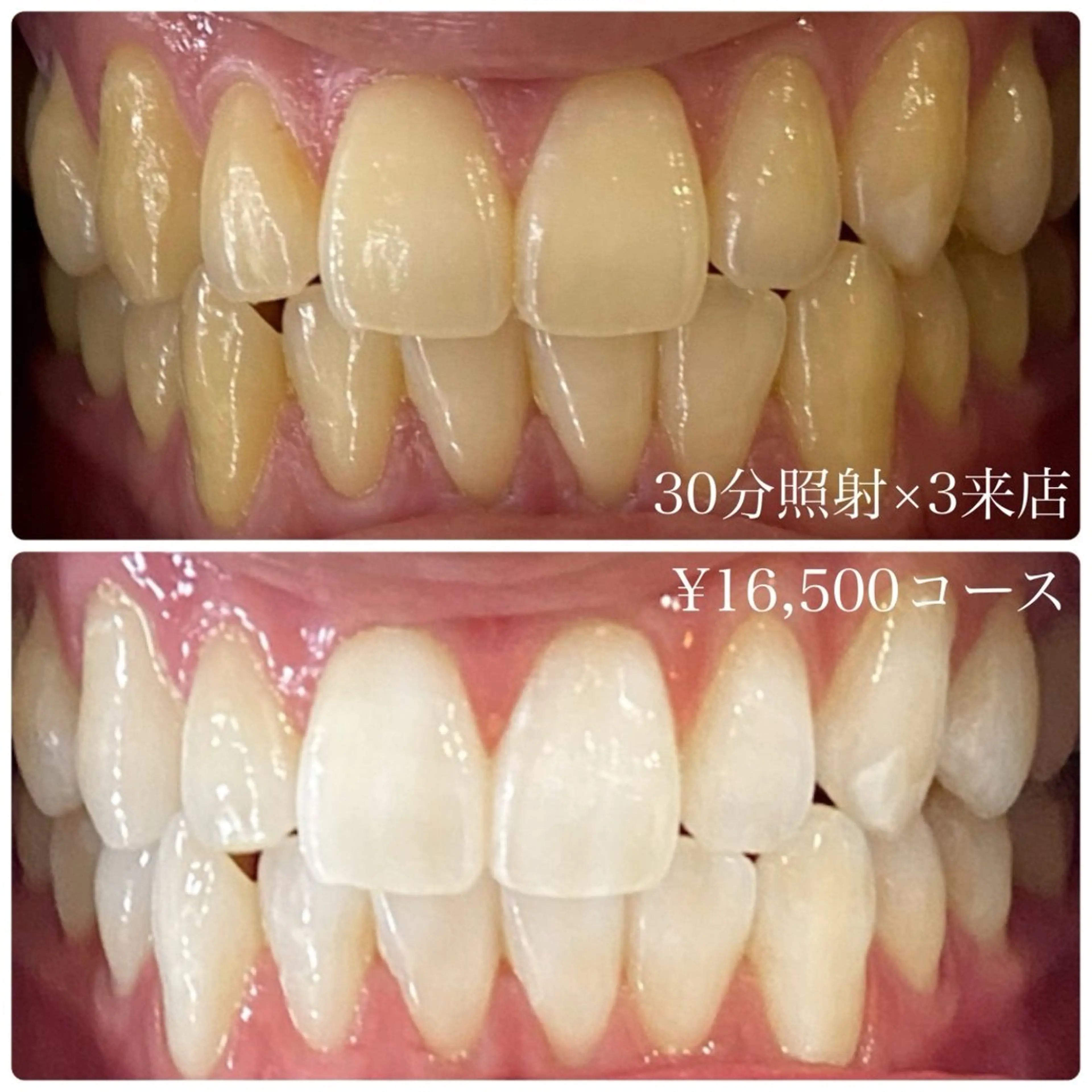 その他 ホワイトニングルーム 横浜店のその他イメージ