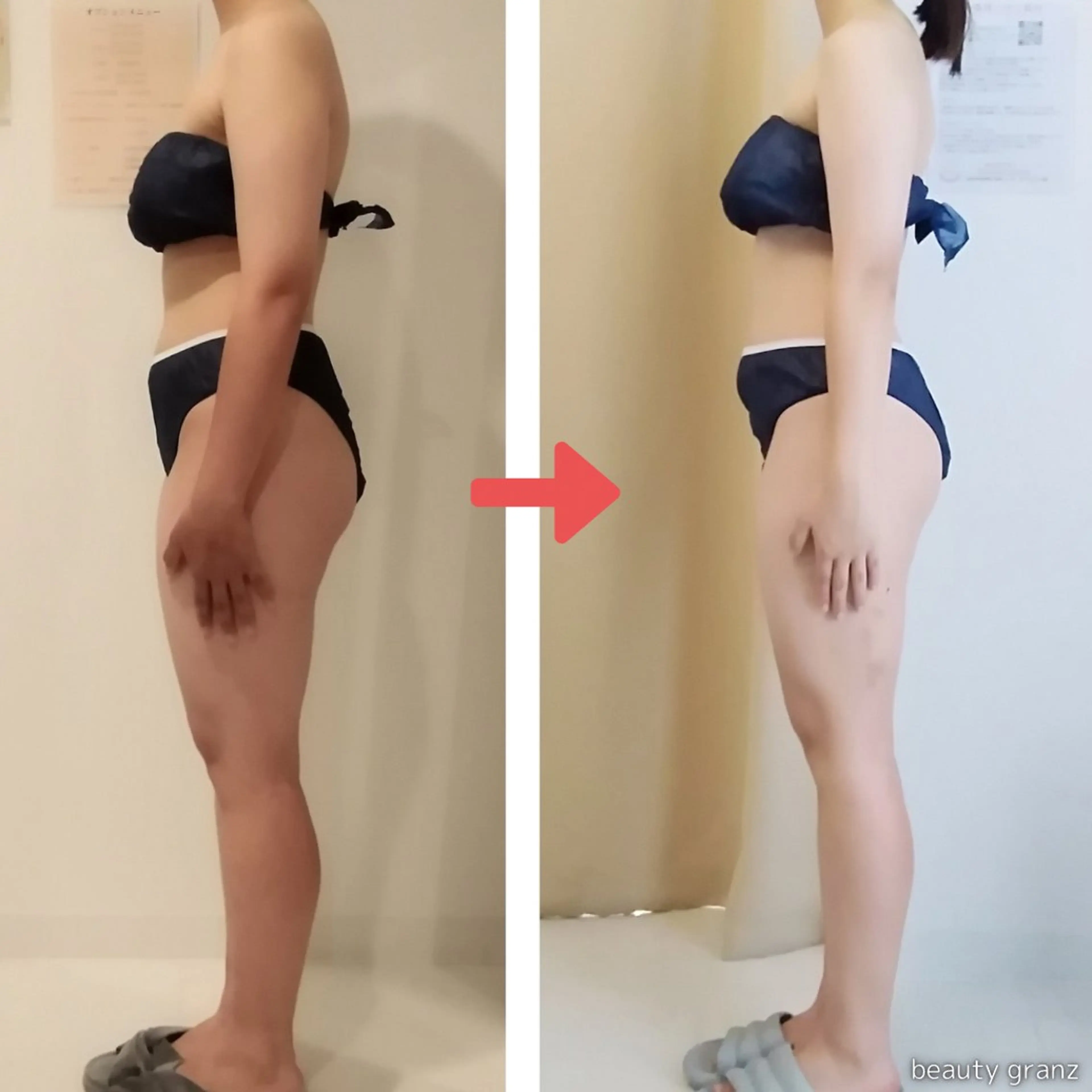 エステ 痩身専門サロン ビューティーグランツのエステ・リラクイメージ