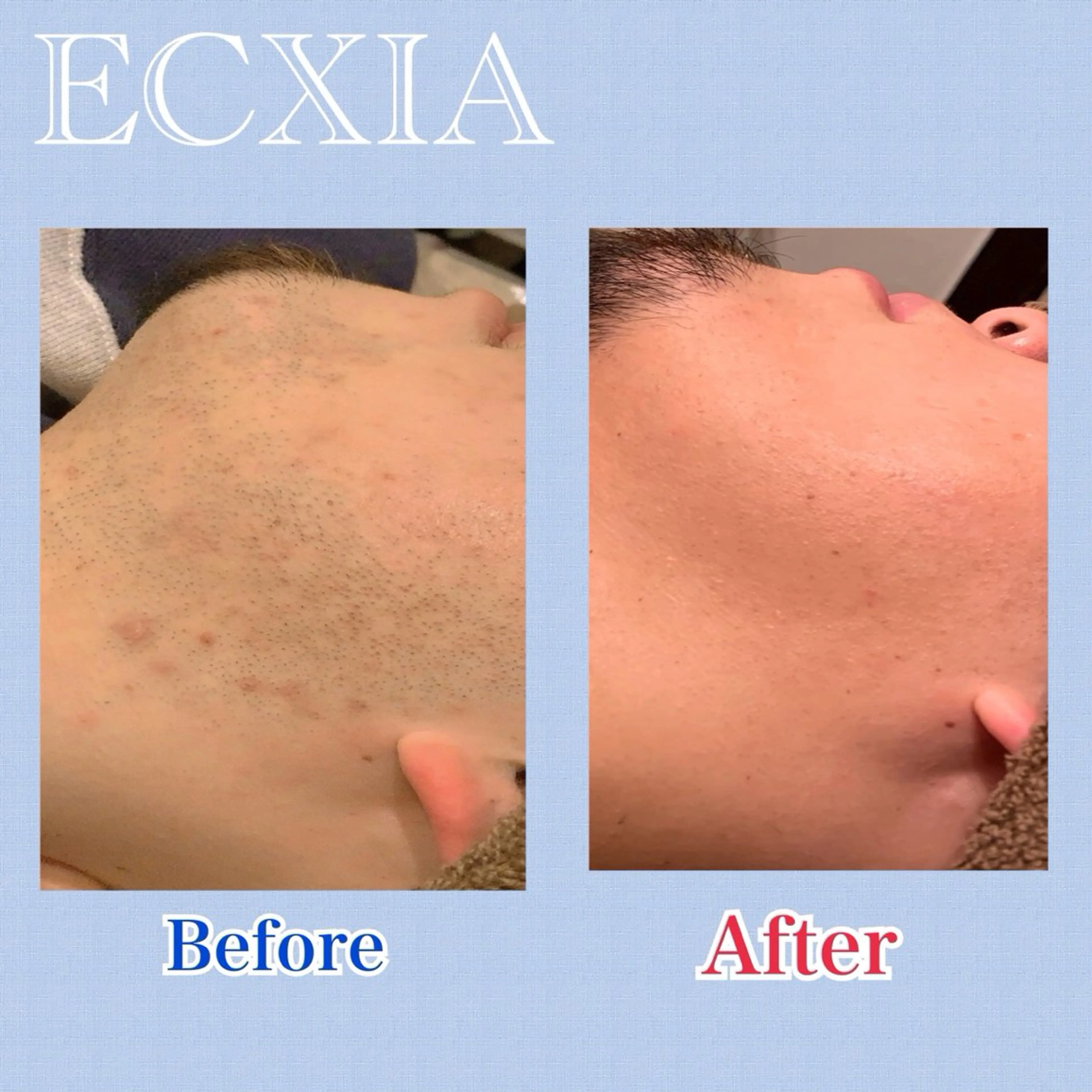 メンズ脱毛 ECXIA博多のエステ・リラクイメージ