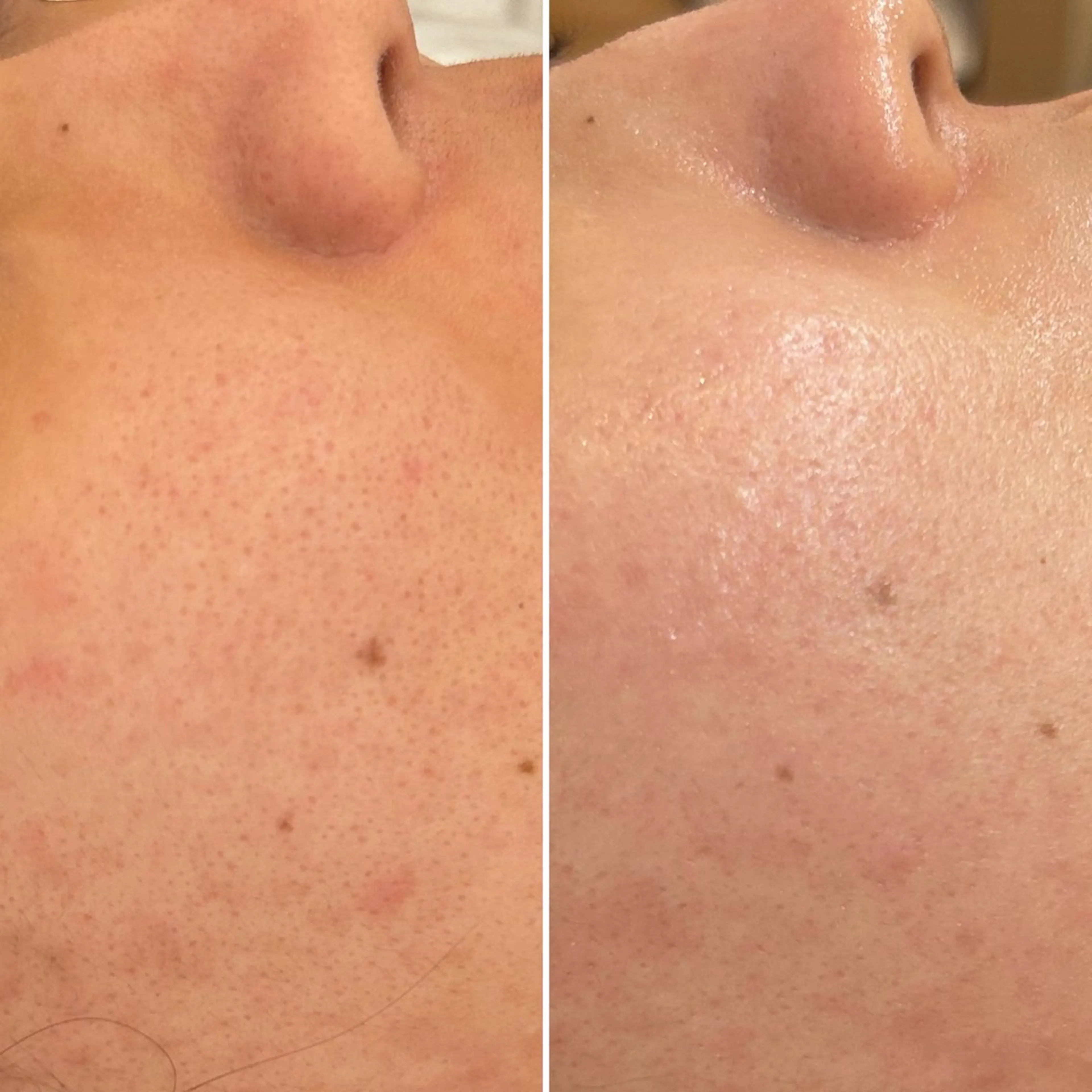 エステ 韓国🇰🇷価格 サロン_Nbibiの眉毛・アイブロウイメージ