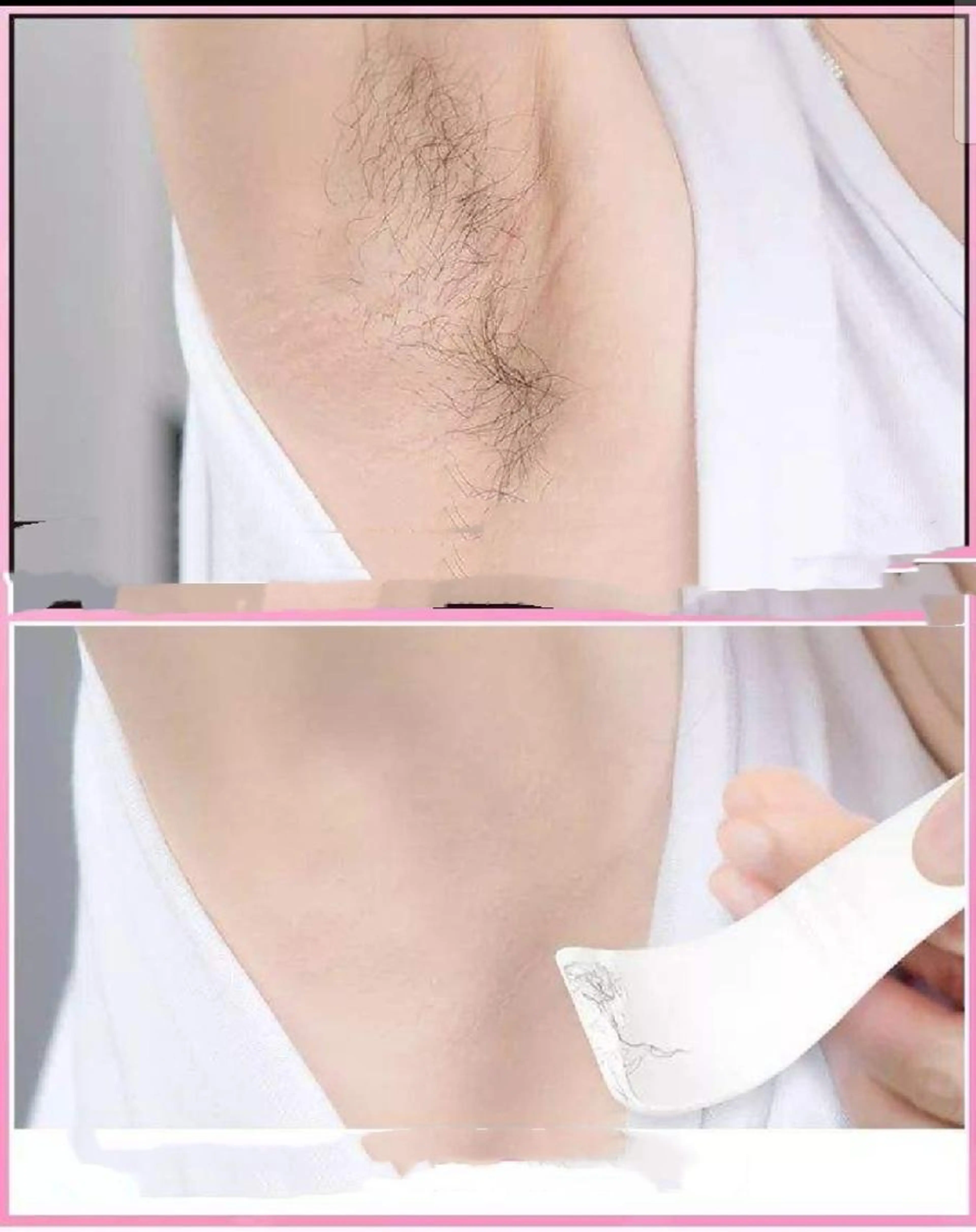 🉐腋1回1500（顔 腕 手指 V I O 全脚 すね 足指 背中 別料金)LED美容脱毛の写真