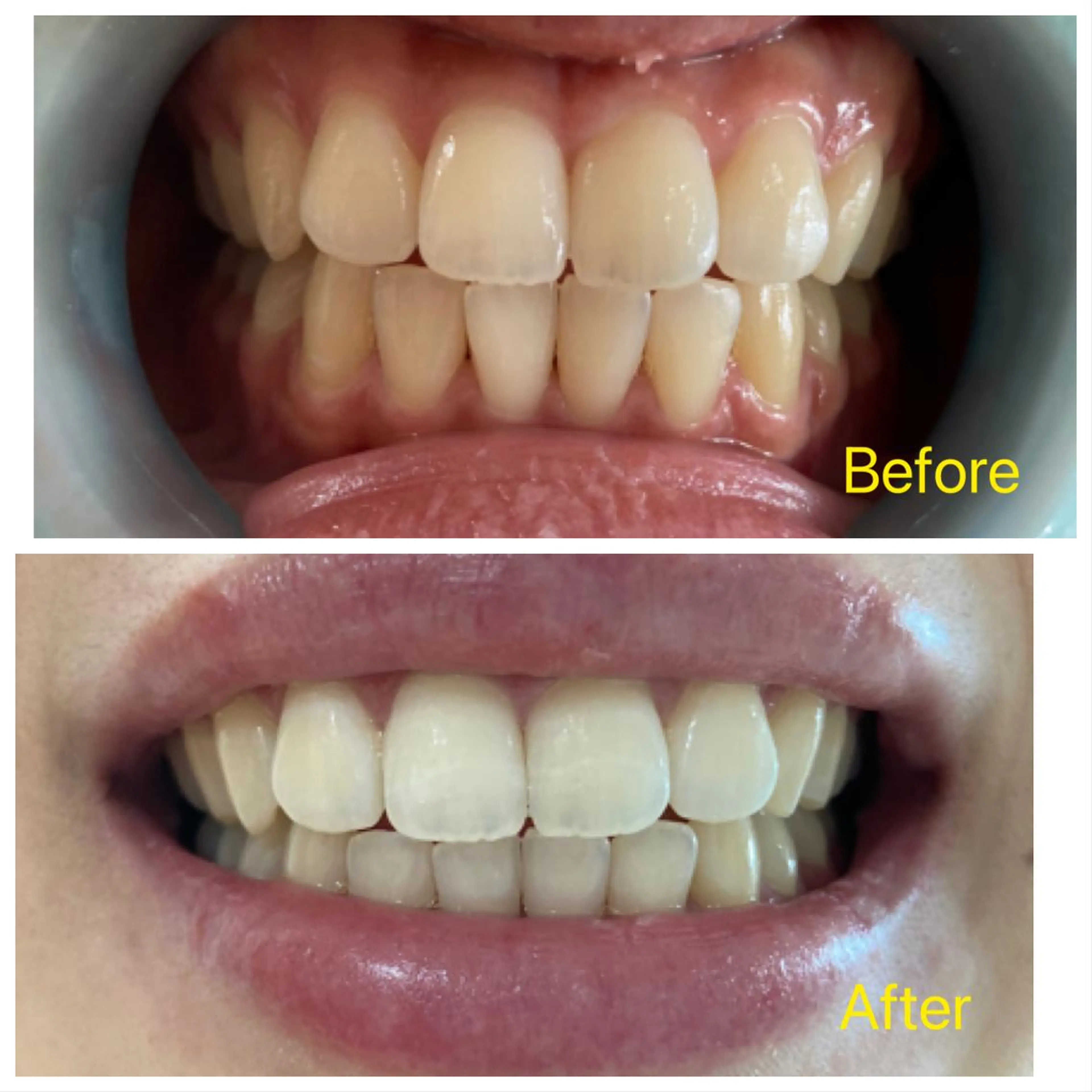 M渋谷 ホワイトニングのエステ・リラクイメージ