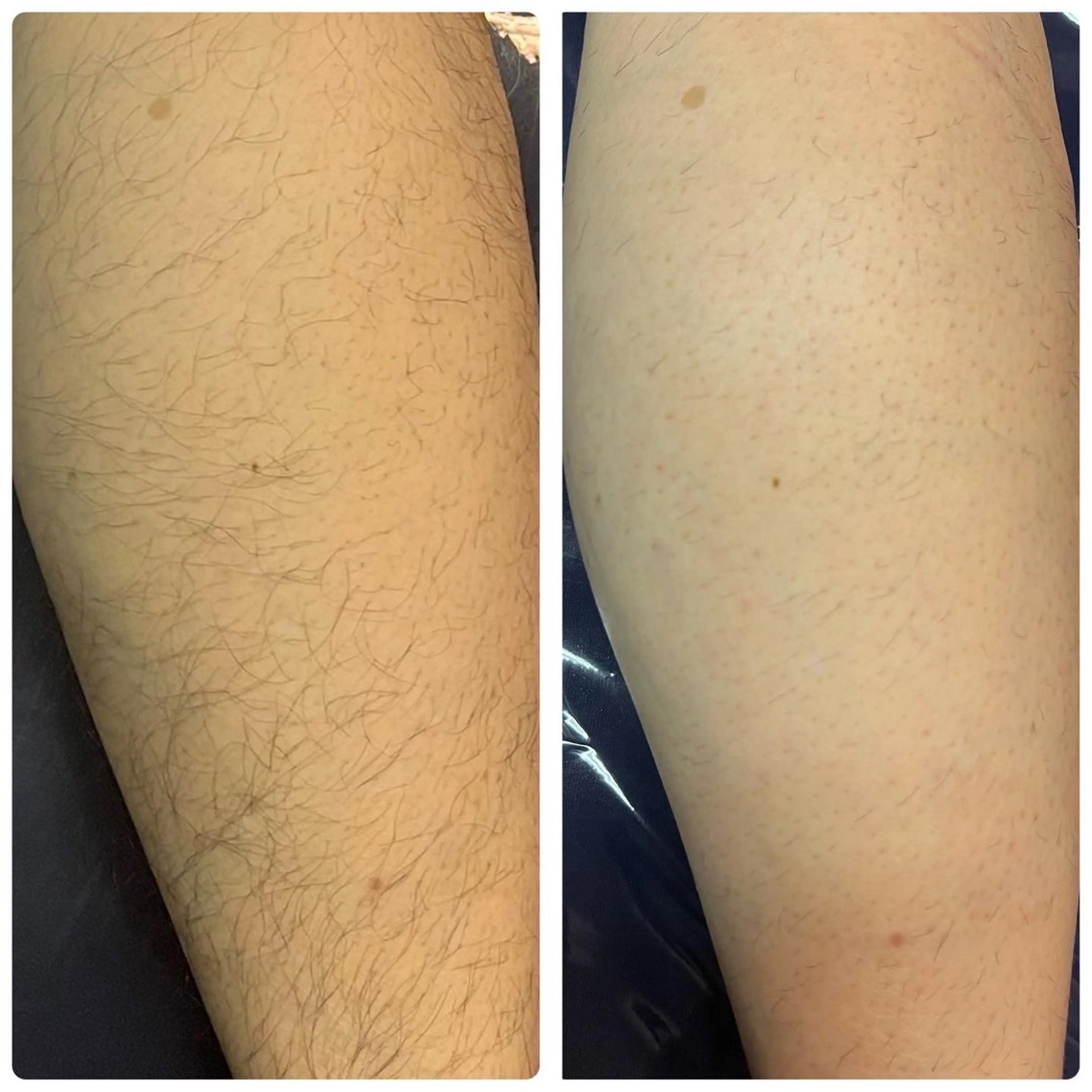 小顔EX心斎橋 REVIハーブのエステ・リラクイメージ