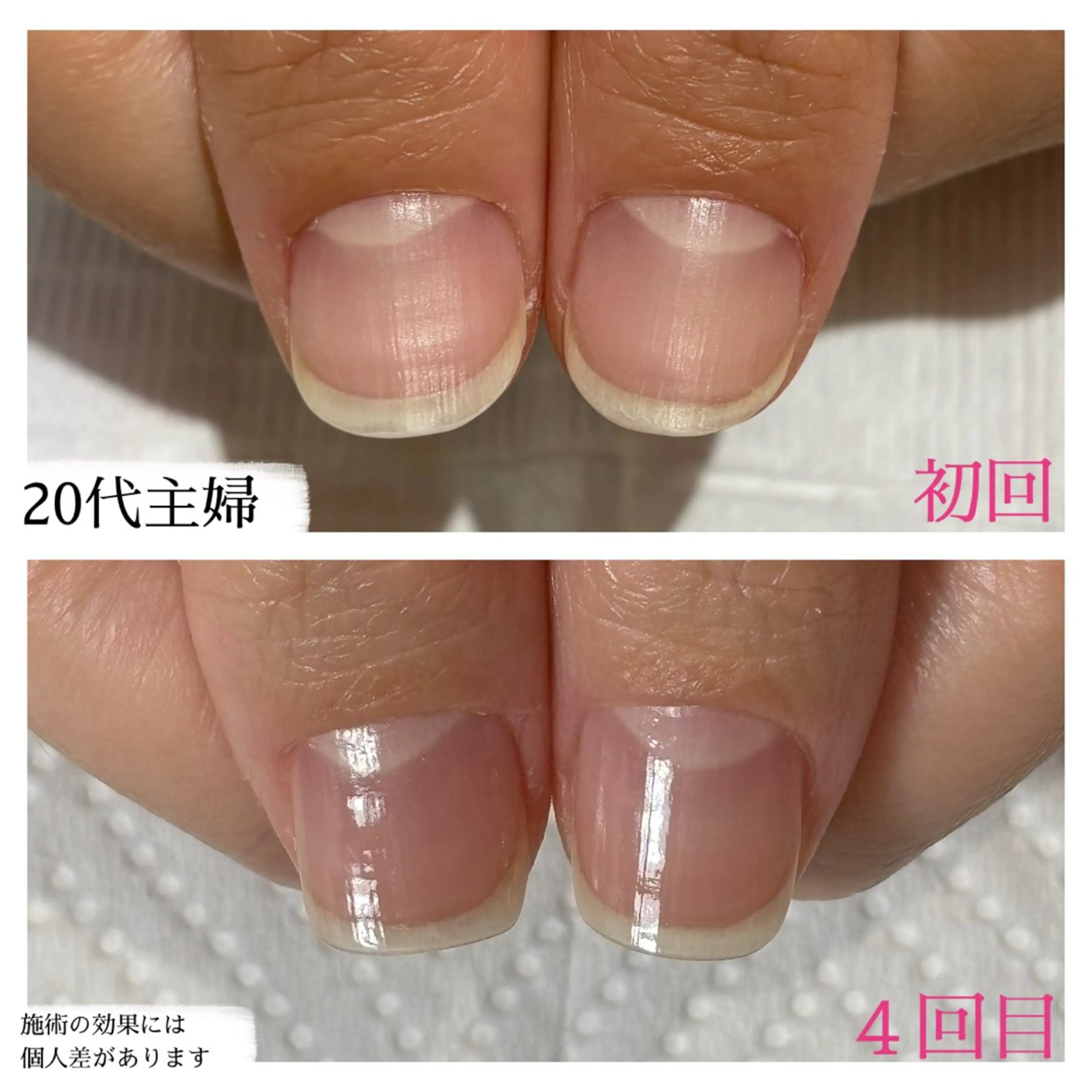 ネイル 自爪育成専門サロン エムロードゥ池下のネイルデザイン