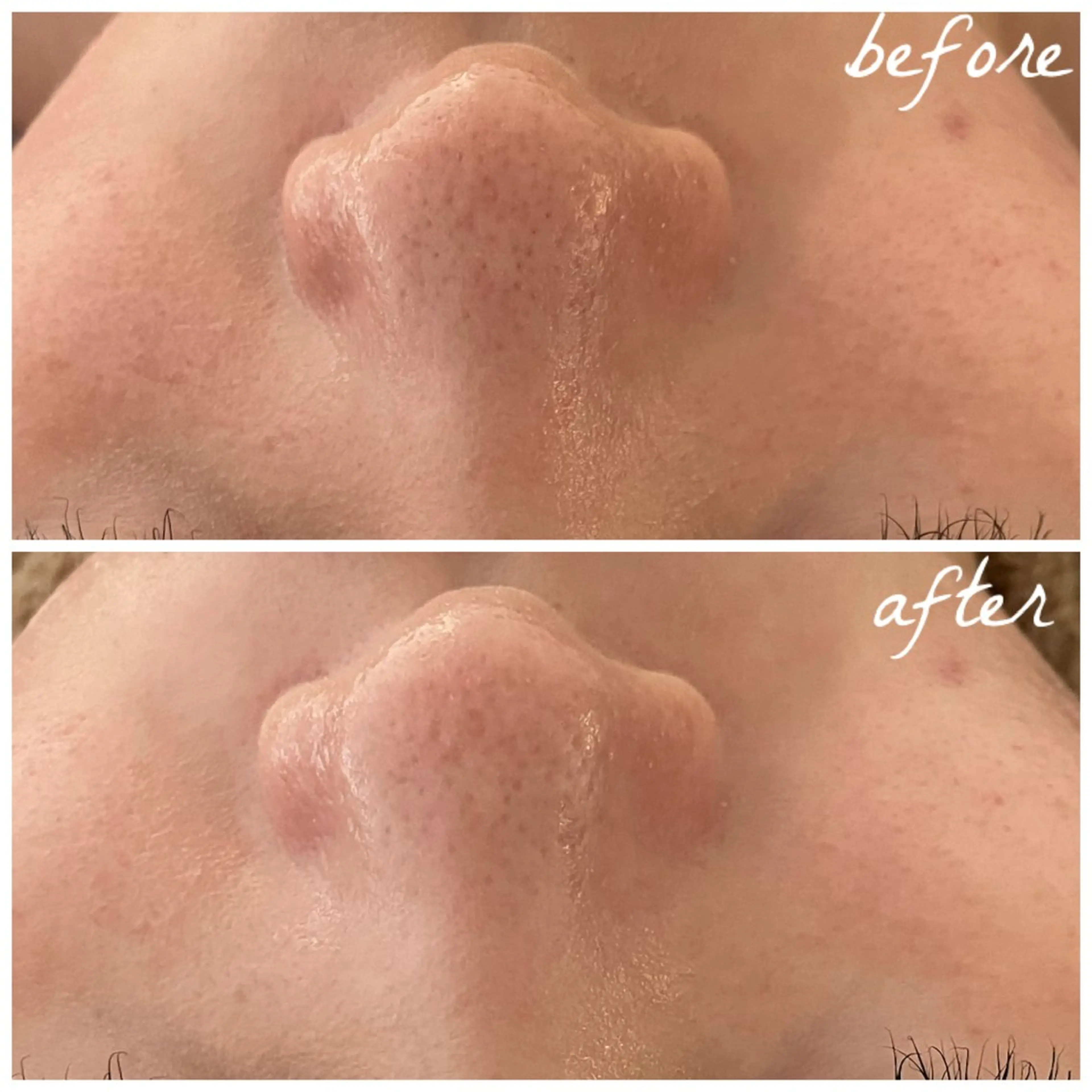 メンズ エステ メナード岐阜市茜部 杉浦のエステ・リラクイメージ