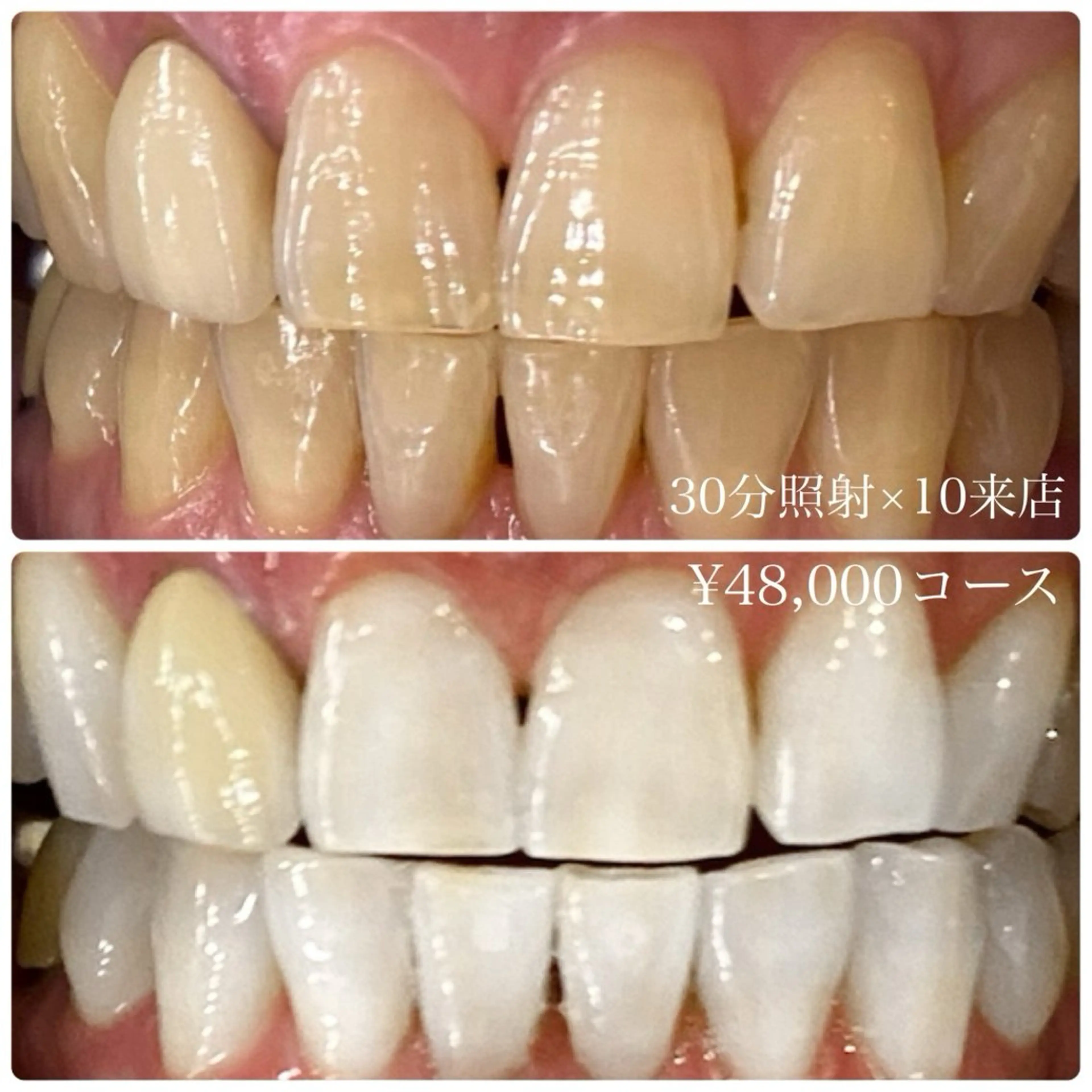 その他 ホワイトニングルーム 横浜店のその他イメージ