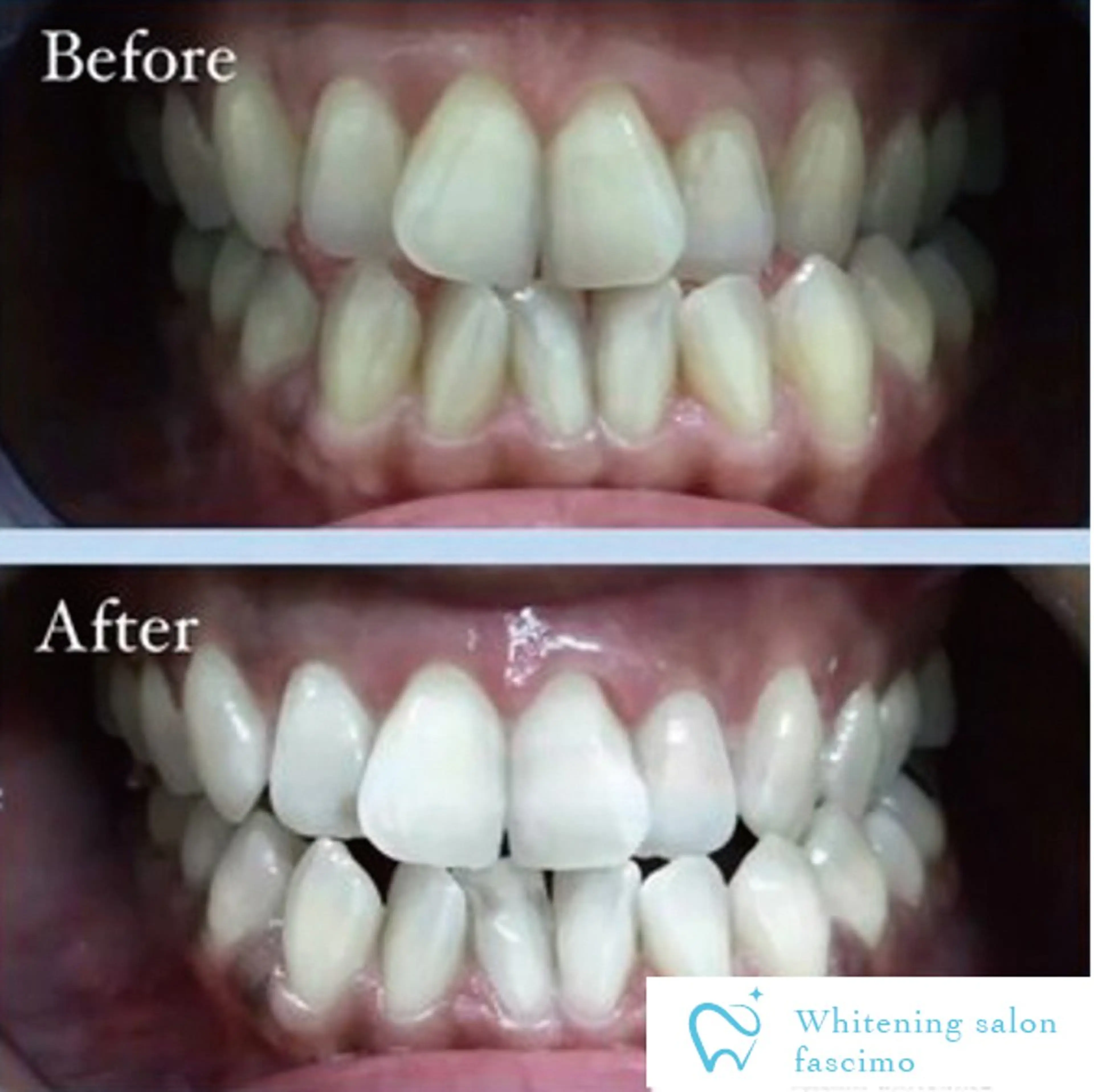 ホワイトニングサロン fascimo新座店のその他イメージ