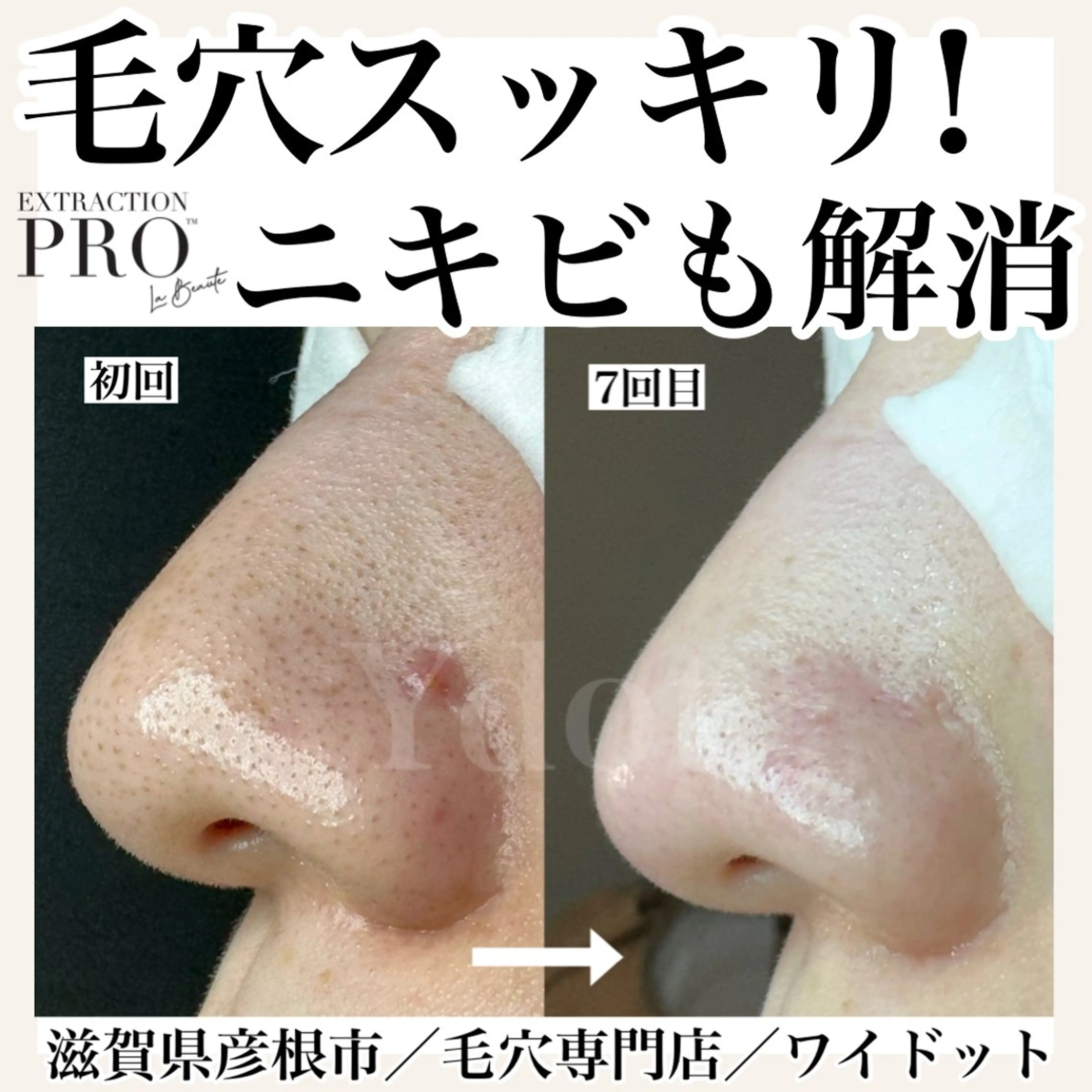 エステ Ydot. 池内 友架のエステ・リラクイメージ