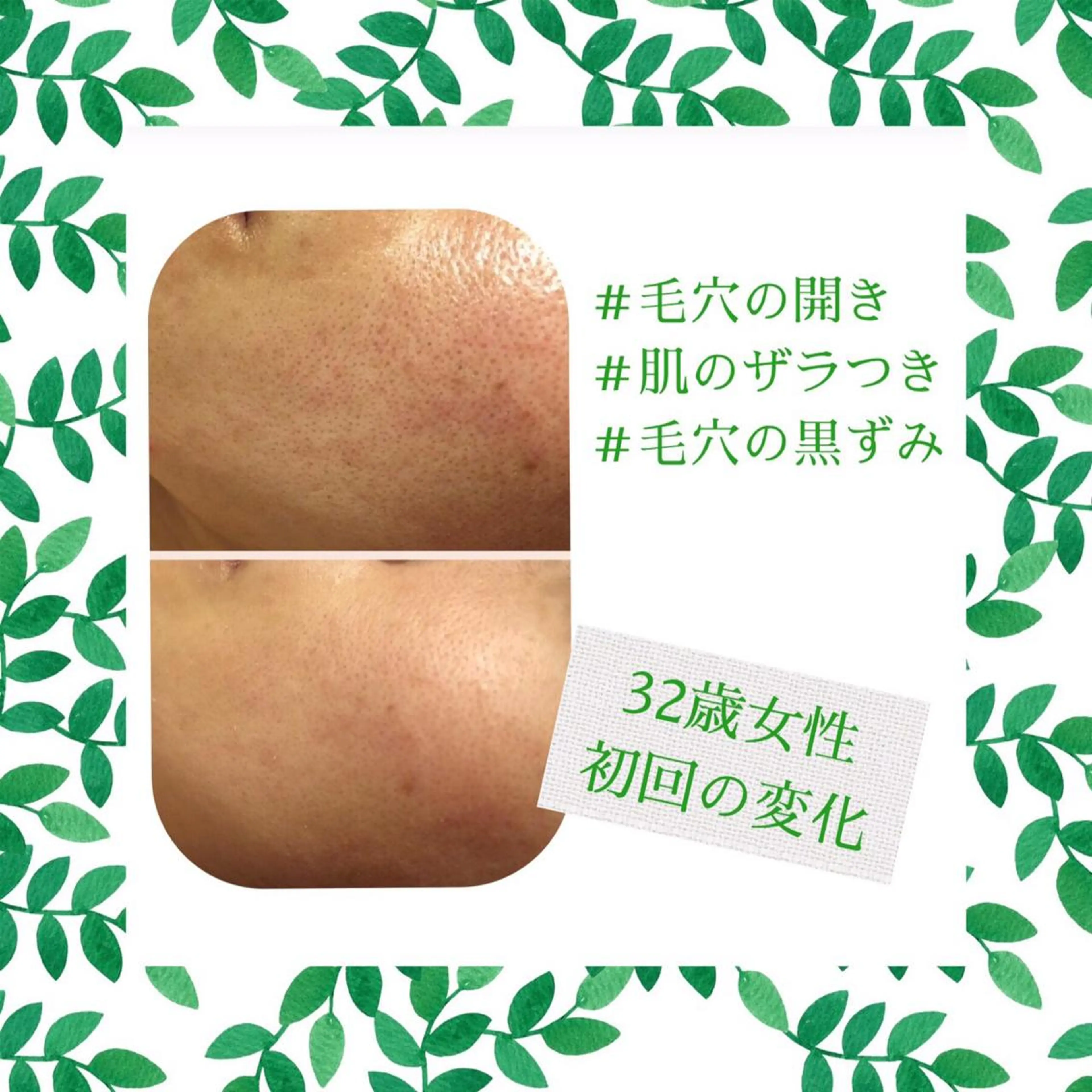 ミディアム カラー パーマ ヘアアレンジ メンズ キッズ ネイル マツエク・マツパ ニキビ・肌質改善専門 ♡人生が変わるサロンのエステ・リラクイメージ